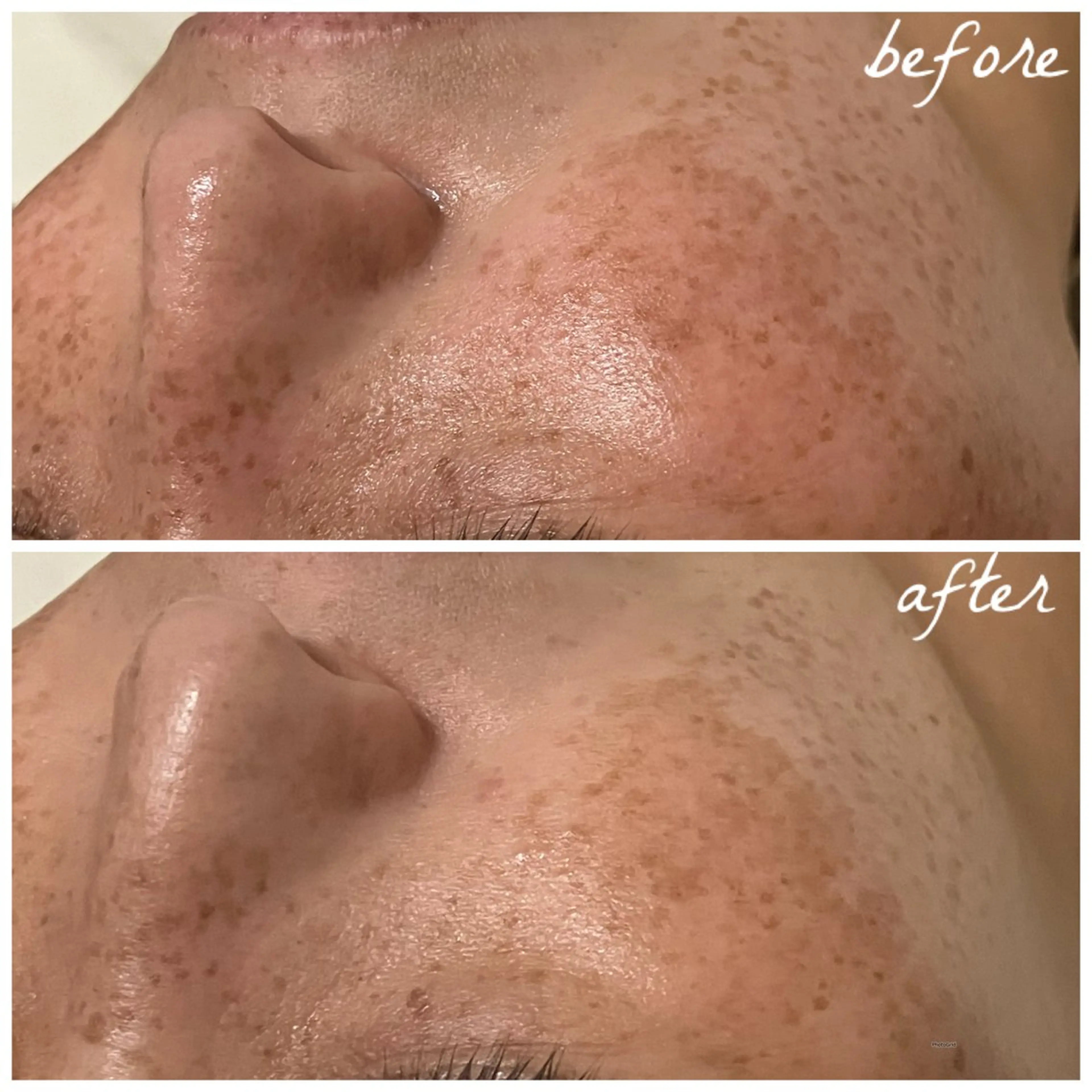 メンズ エステ メナード岐阜市茜部 杉浦のエステ・リラクイメージ