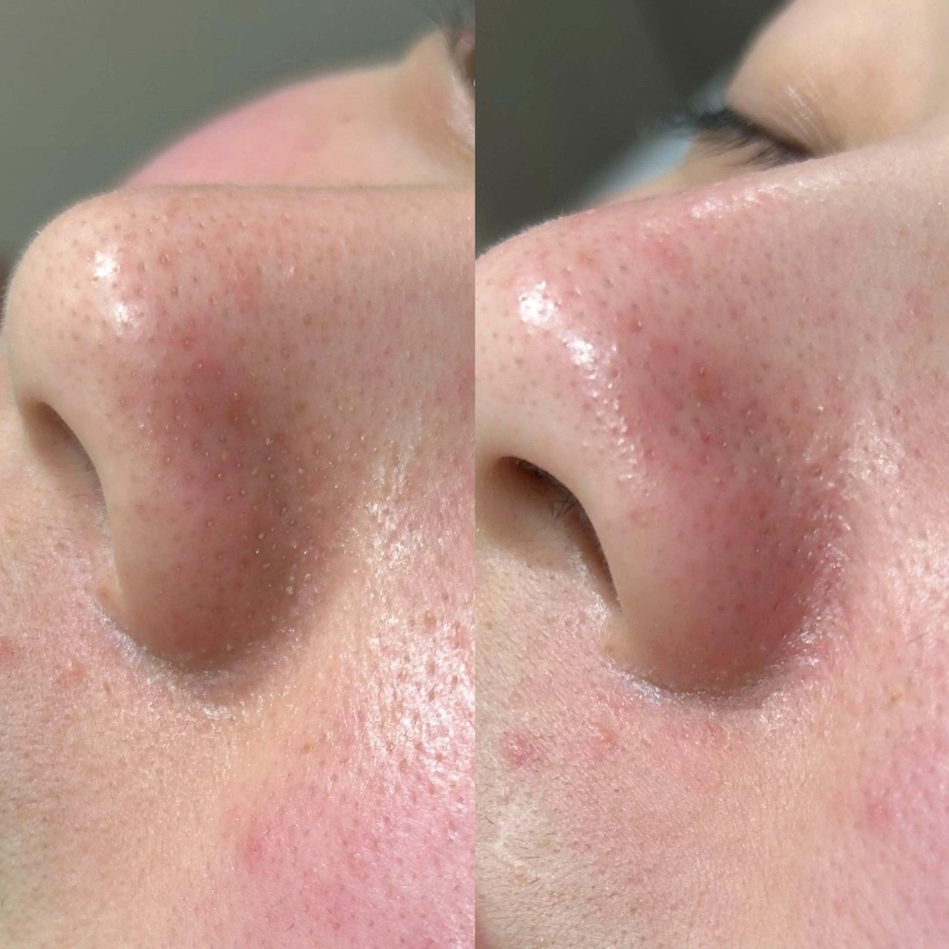 エステ EARTH 小林 郁海のエステ・リラクイメージ