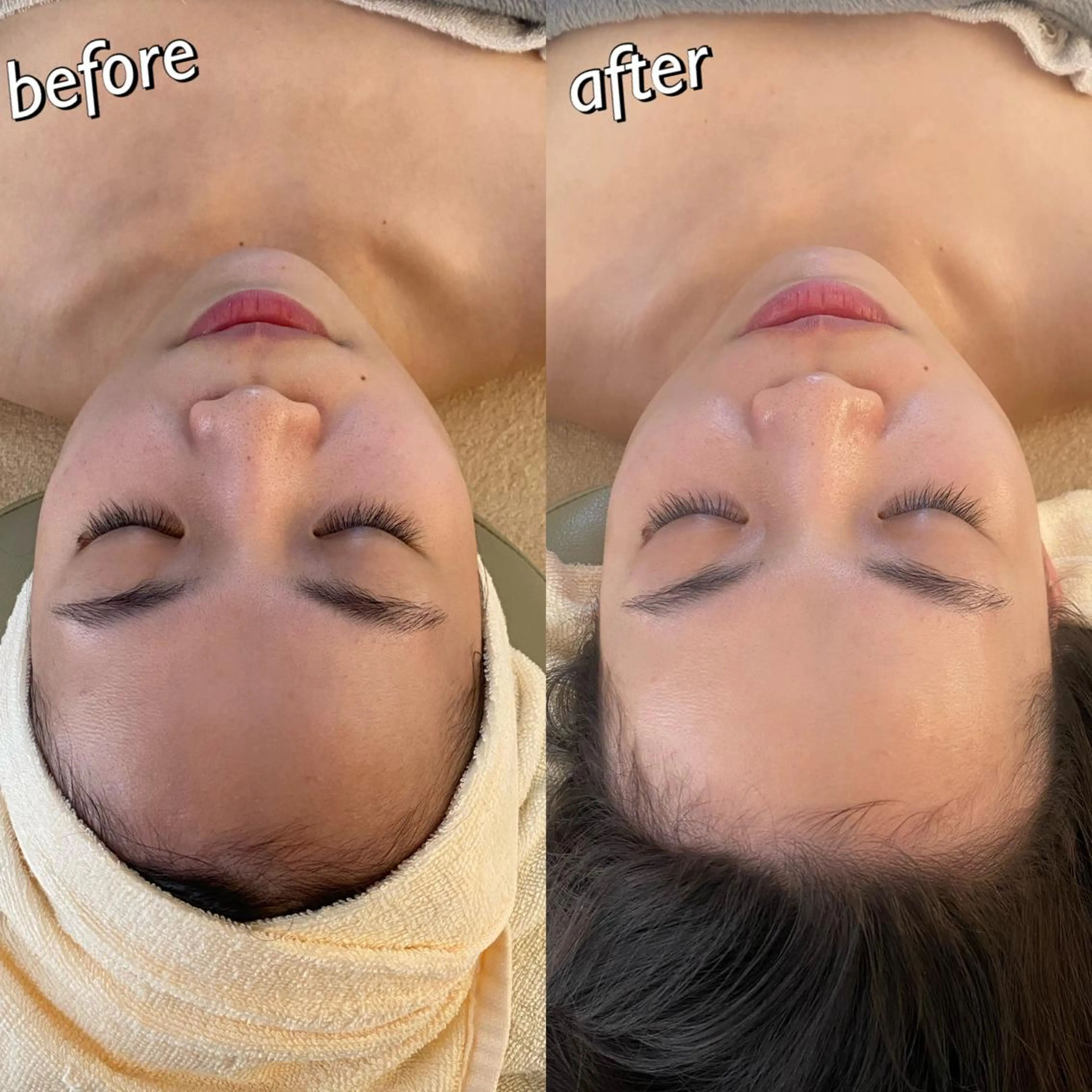 うなじ脱毛/美肌脱毛 LABELのエステ・リラクイメージ