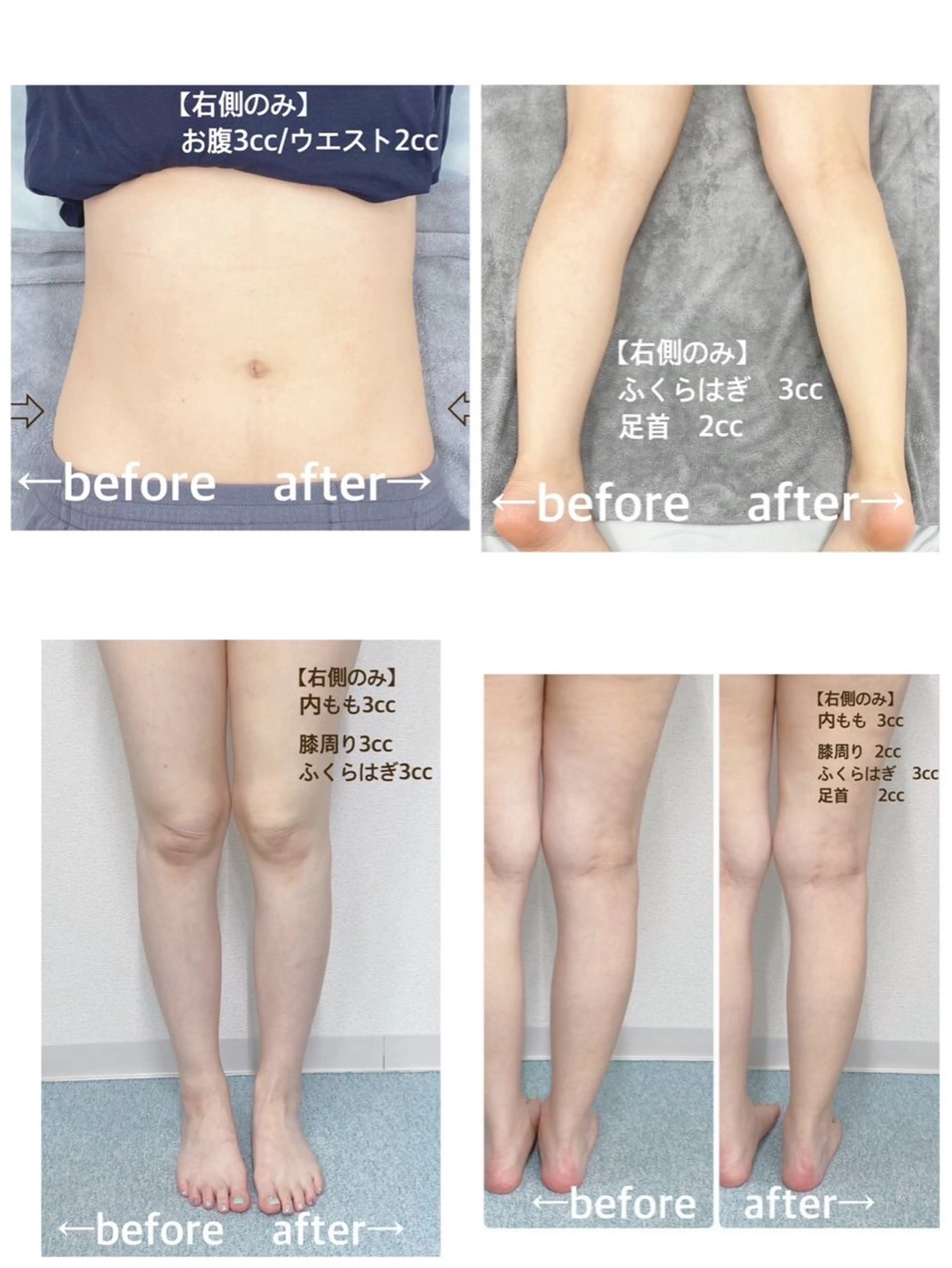 小顔痩身HALO 二宮早織のエステ・リラクイメージ