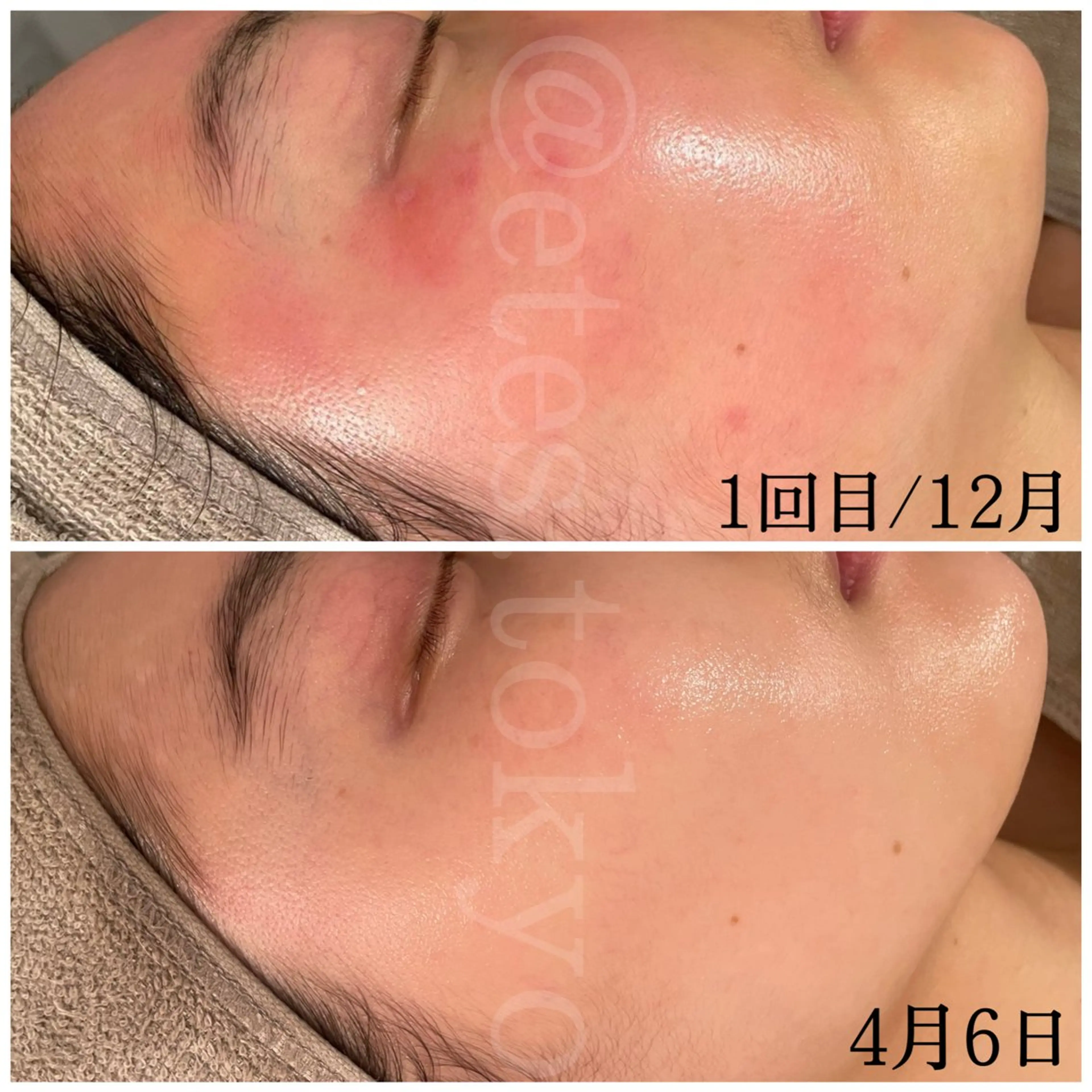 etes.tokyo 中目黒のエステ・リラクイメージ