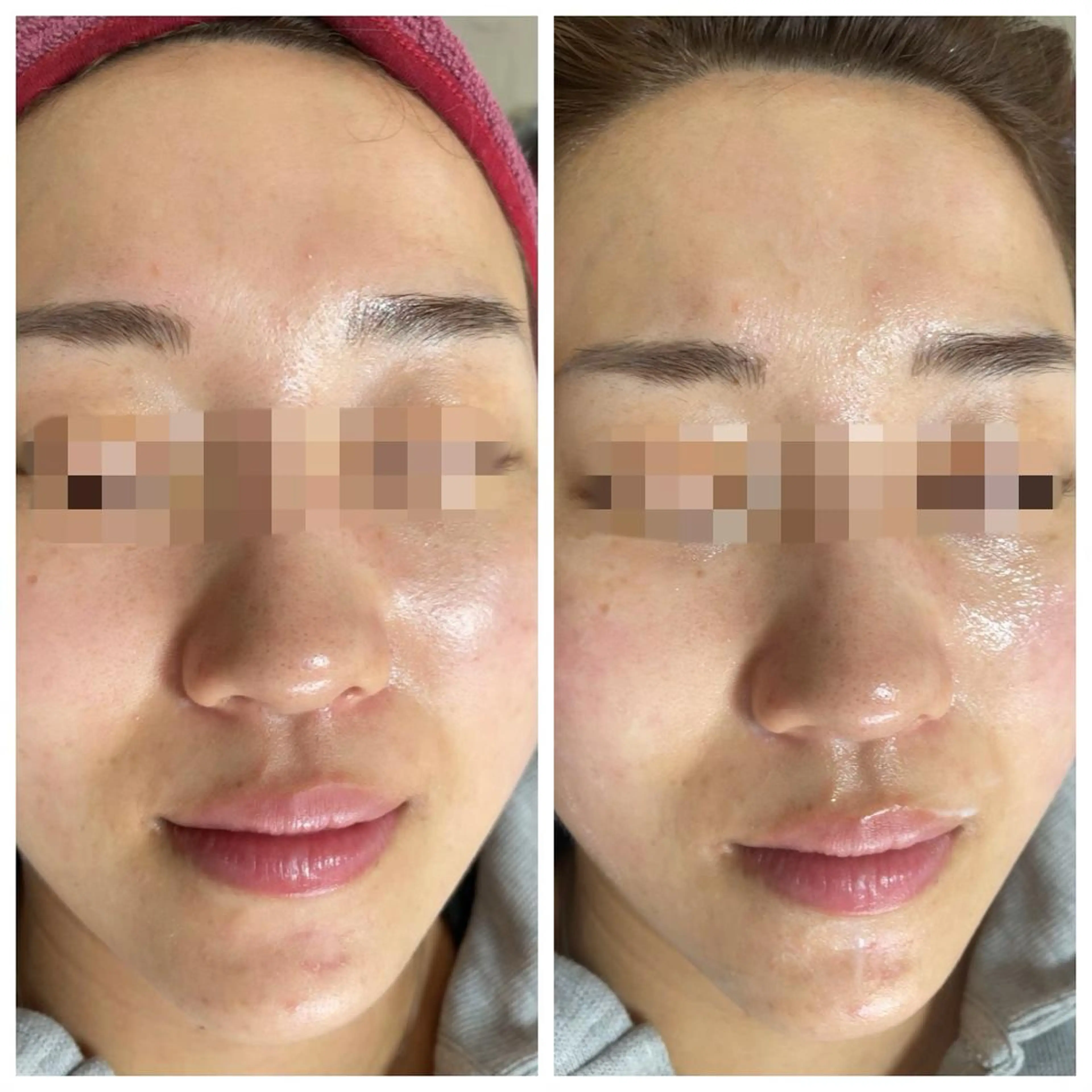 肌質改善サロン facialmoonのエステ・リラクイメージ