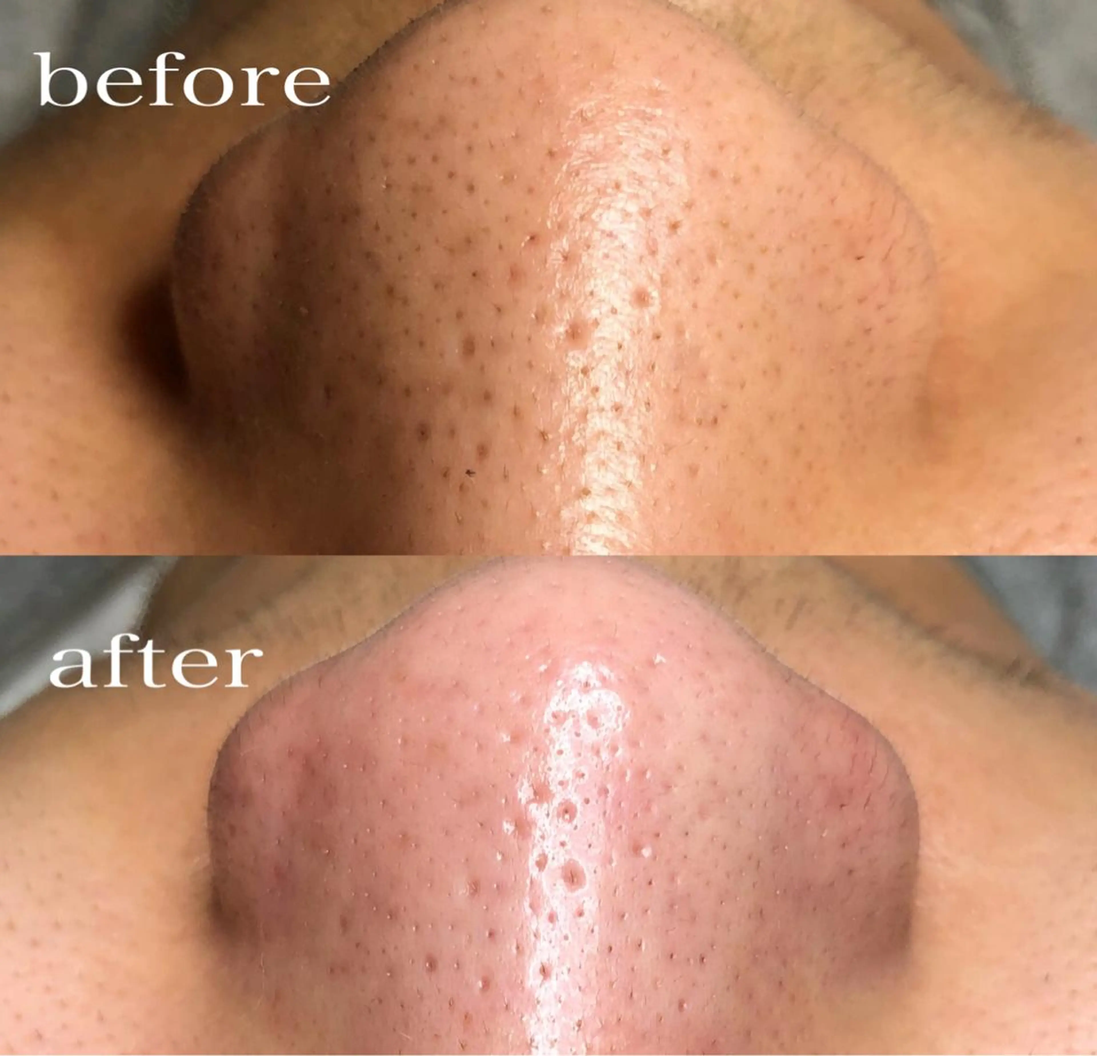 メンズ Petit maisonのネイルデザイン