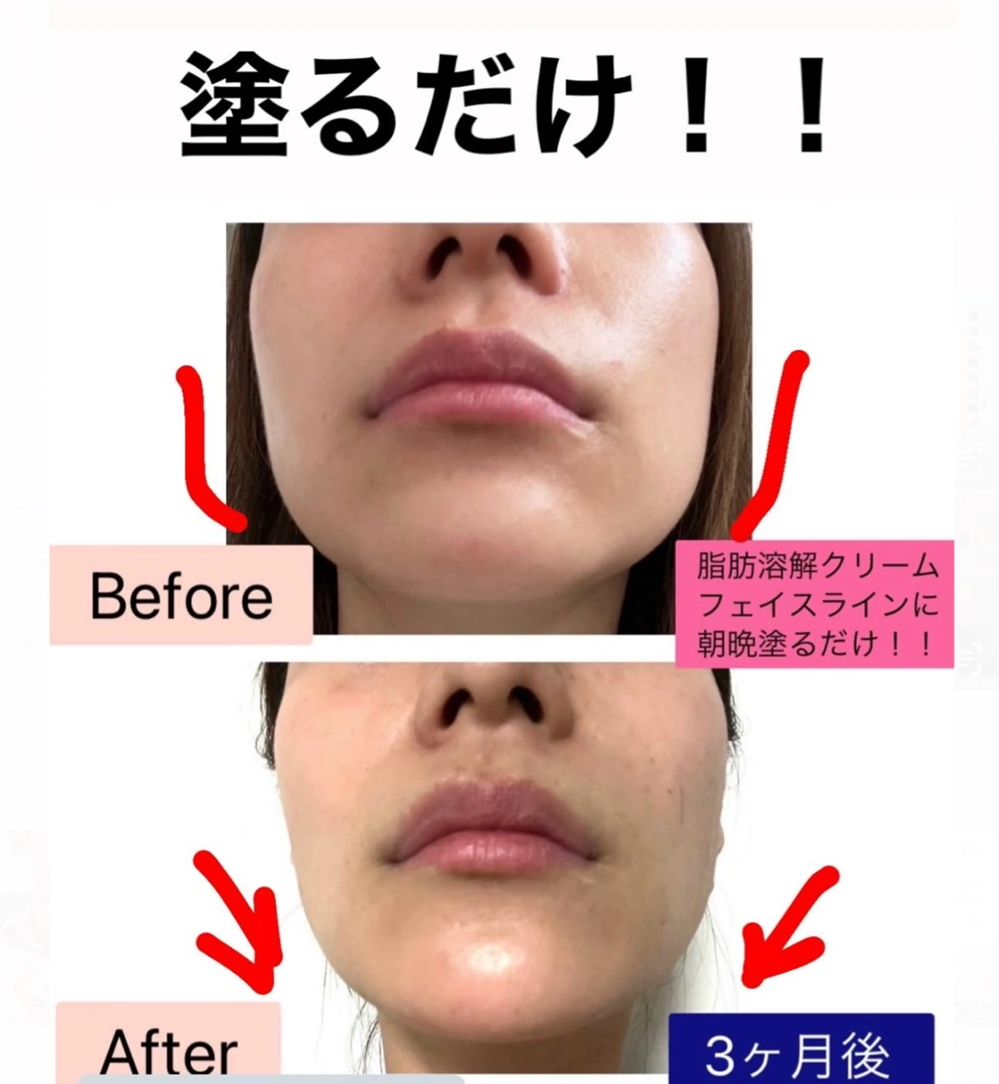 ブライダル痩身×脱毛 尼崎駅前サロンのエステ・リラクイメージ