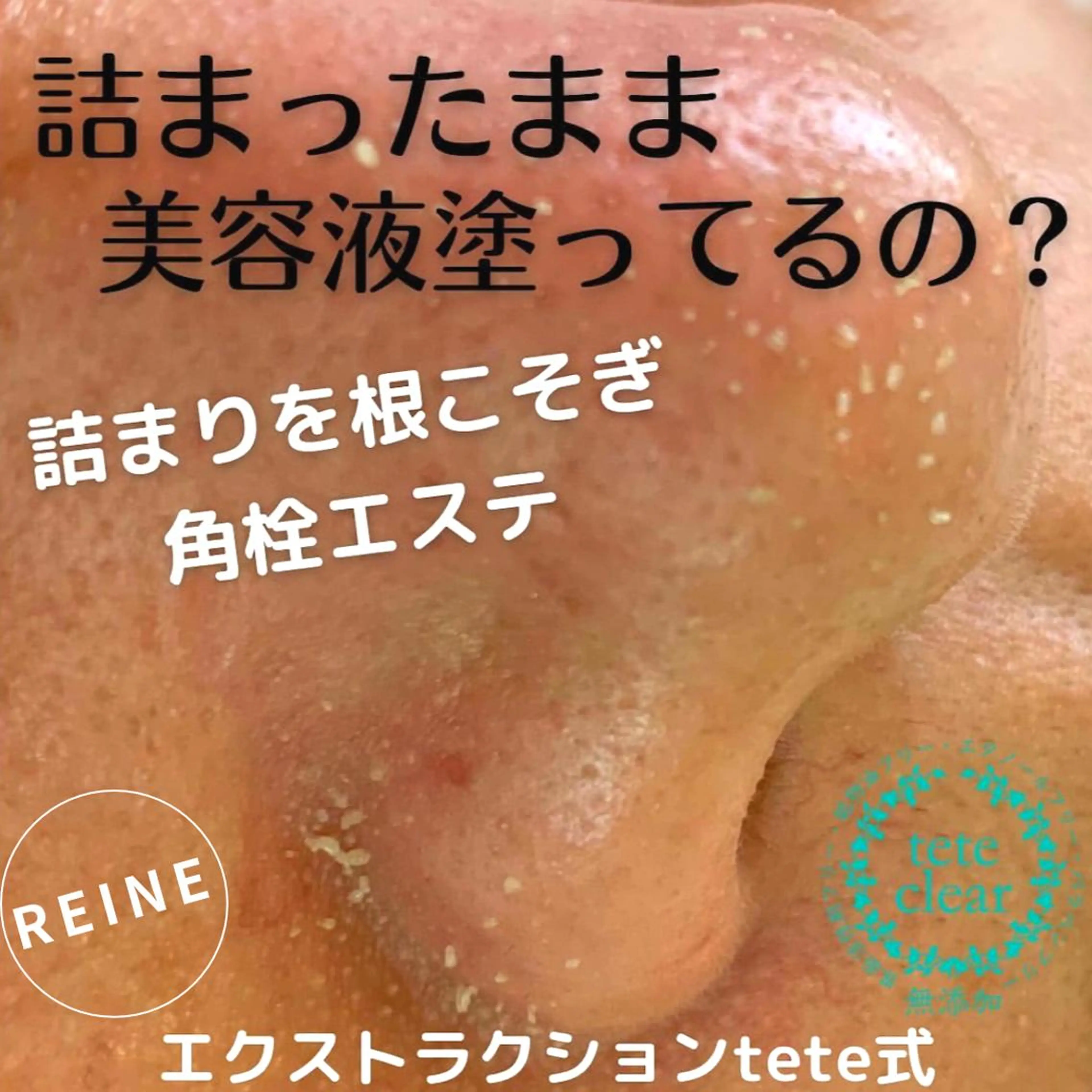 毛穴/シミ肝斑/脱毛 横山梨里のエステ・リラクイメージ