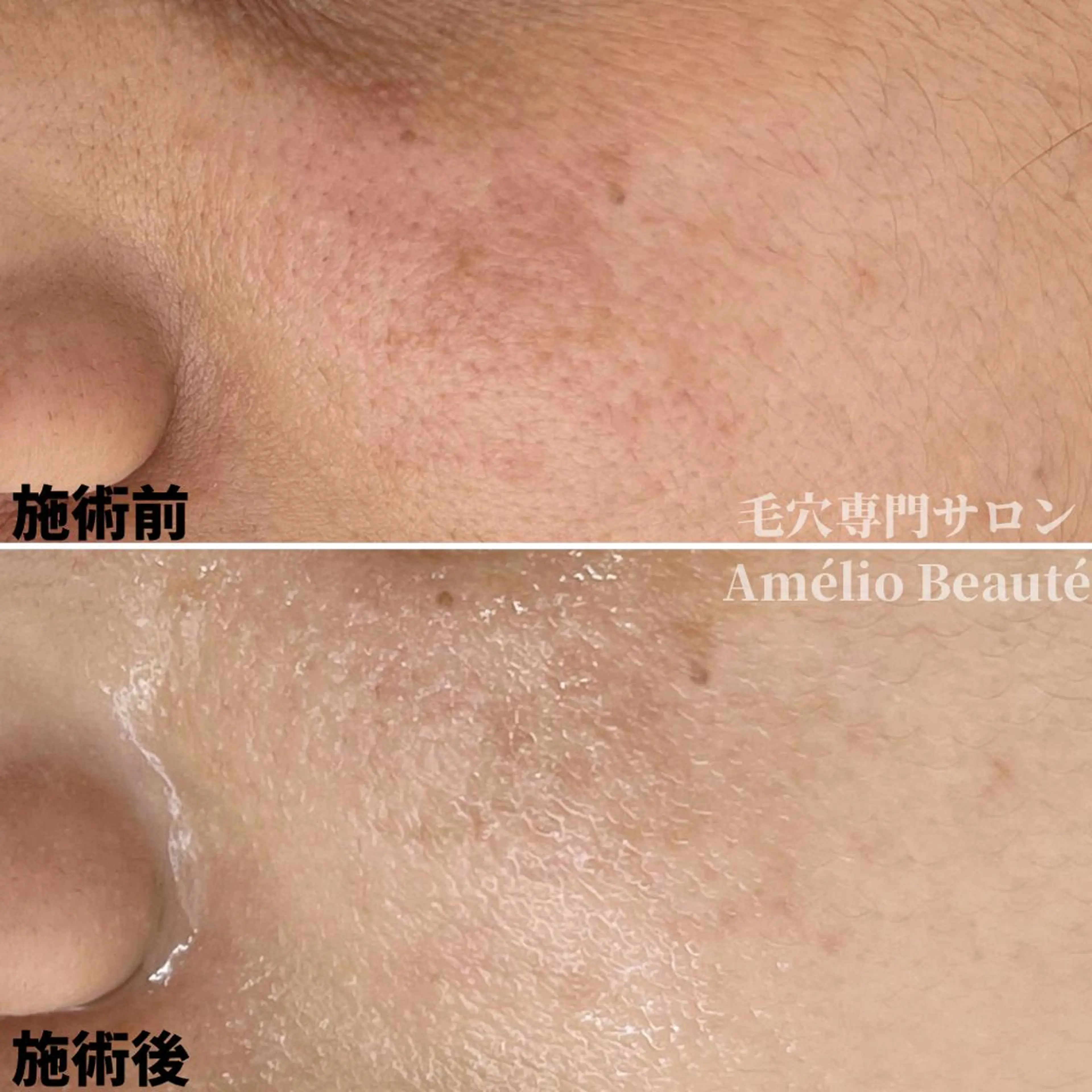 毛穴ケア専門サロン アメリオボーテのその他イメージ