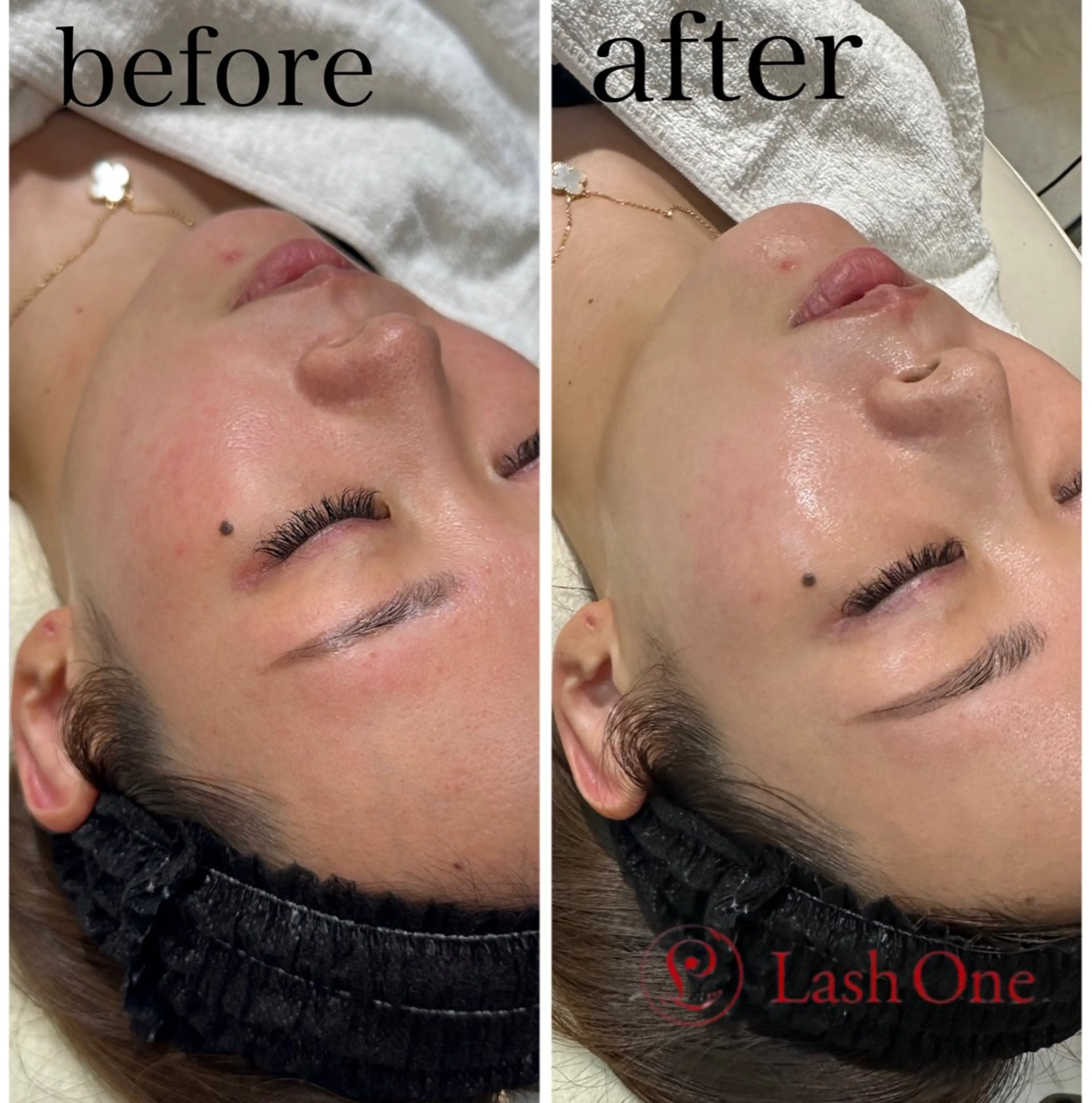 エステ Lash  One 四条店のエステ・リラクイメージ