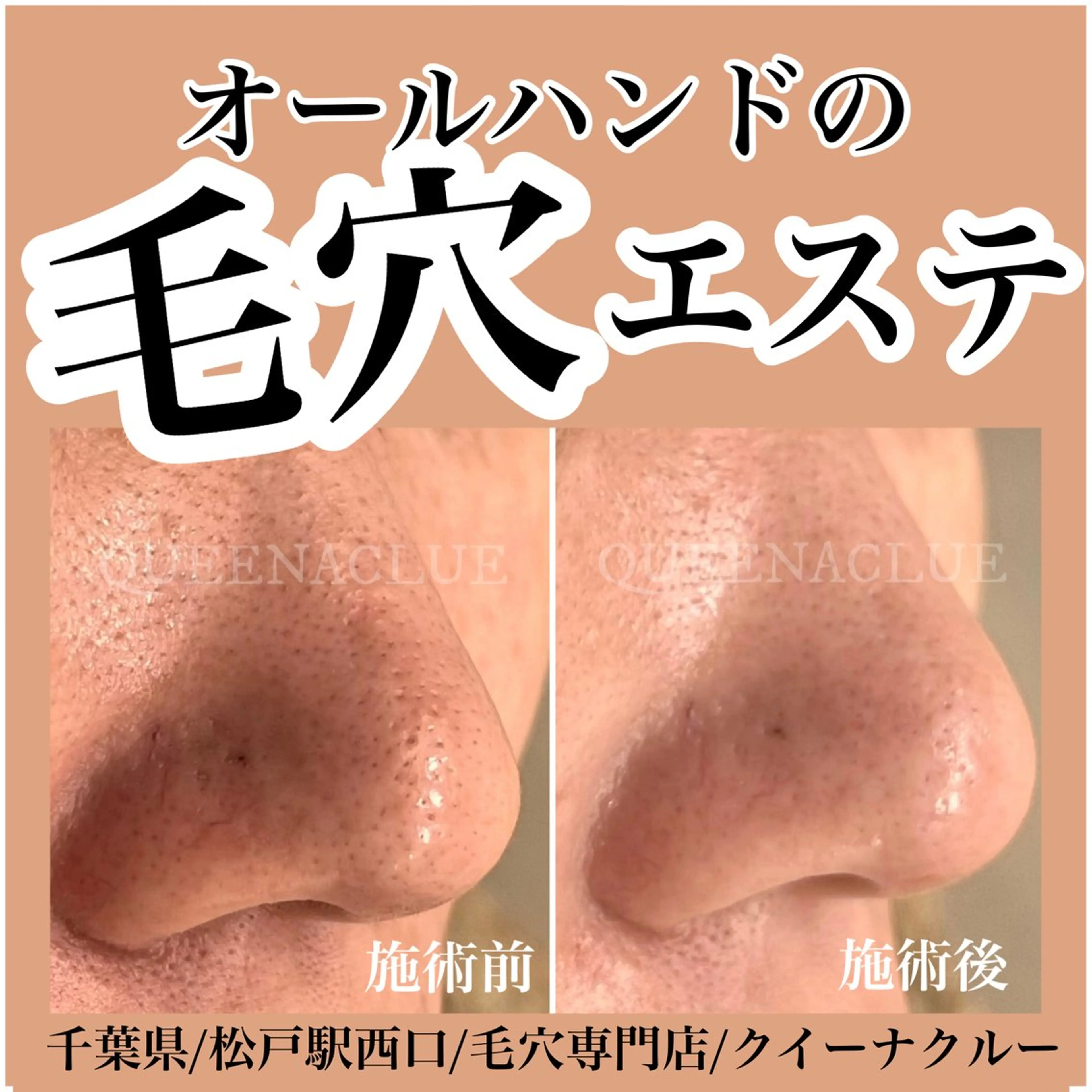 毛穴改善/脱毛 ネイル　川上久仁子のエステ・リラクイメージ