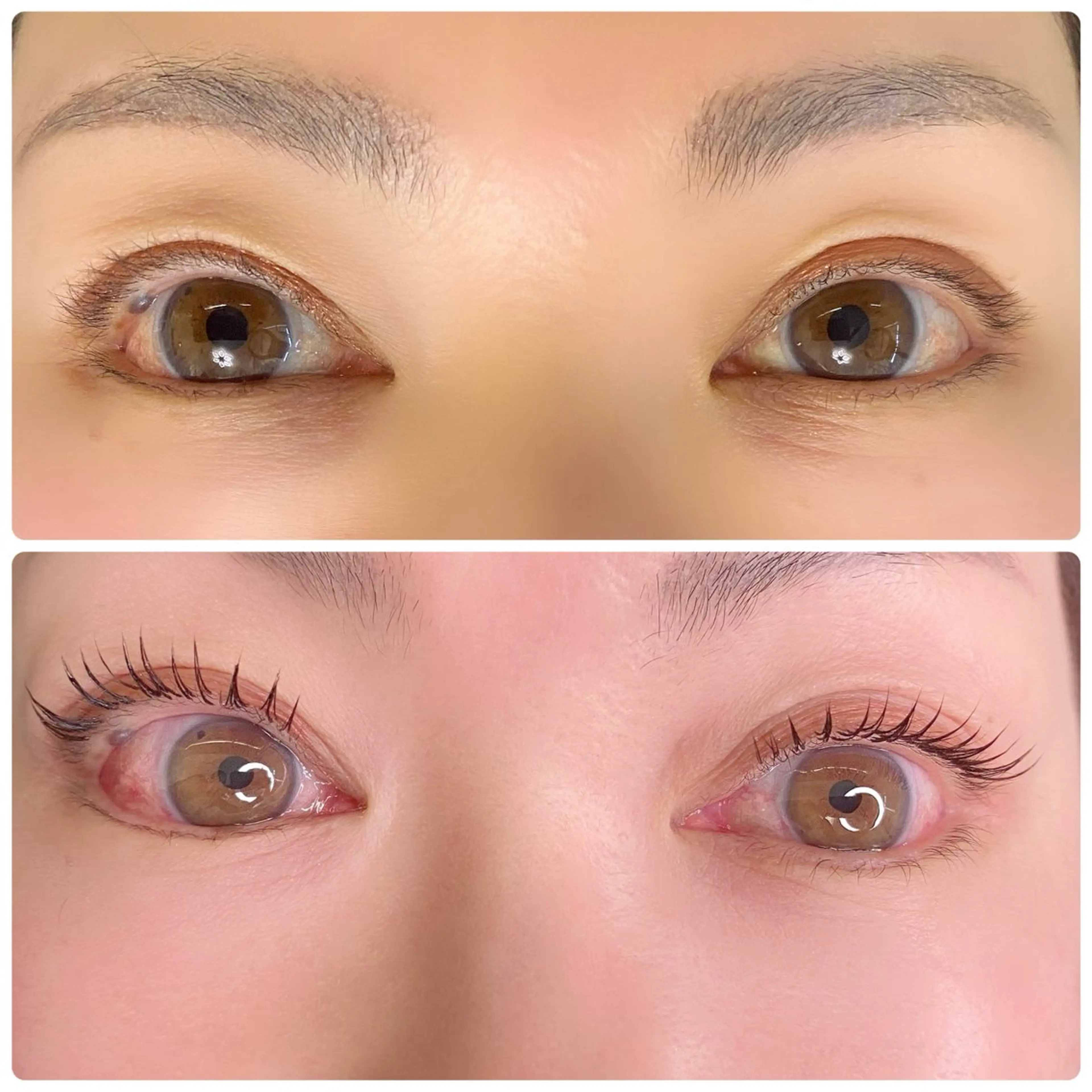 バインドロック100束の写真