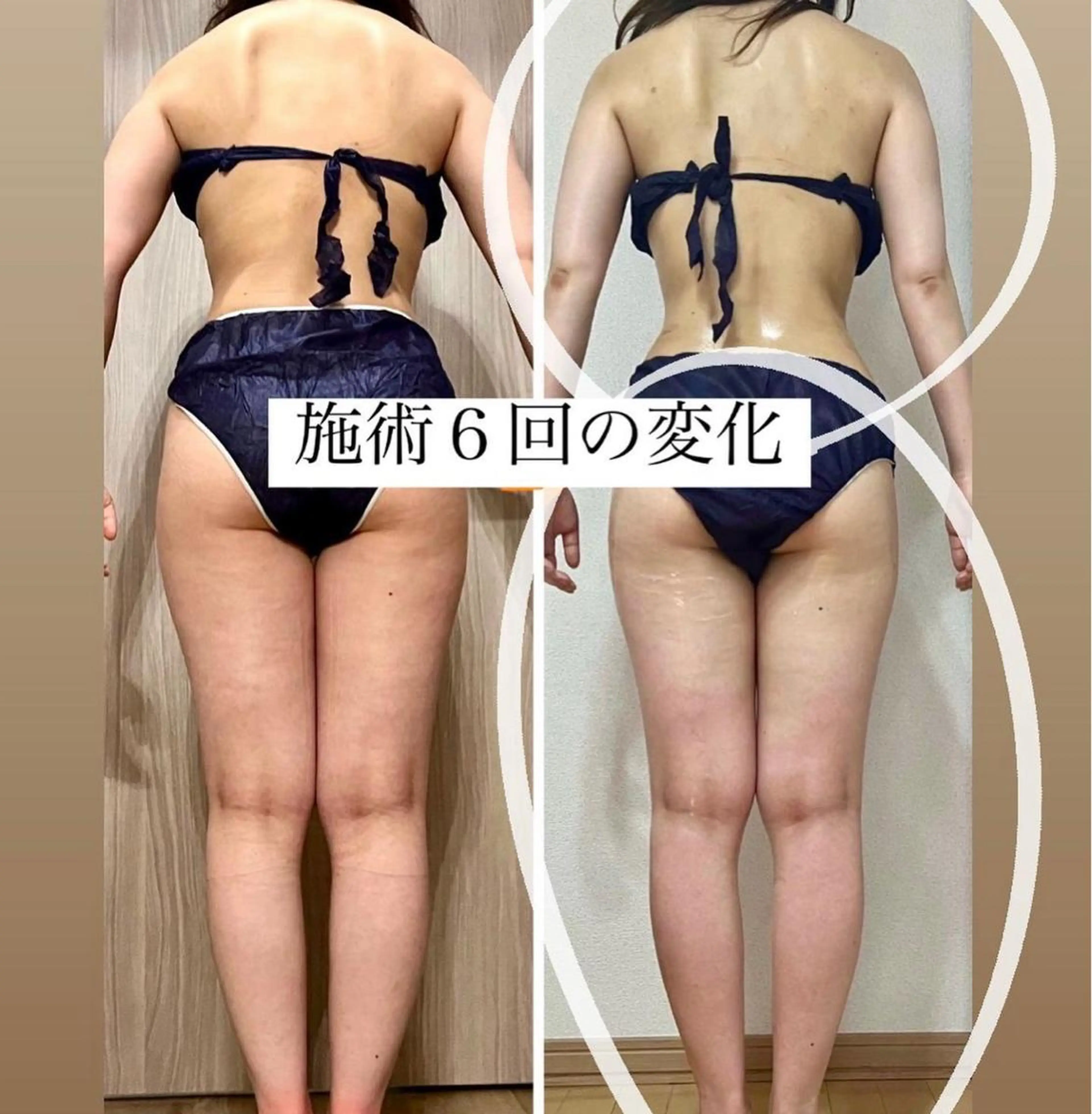 ショート カラー パーマ ヘアアレンジ メンズ キッズ ネイル マツエク・マツパ アイブロウ エステ リラク ‍痩身＆ボディ 結果出し🌟丹野のエステ・リラクイメージ