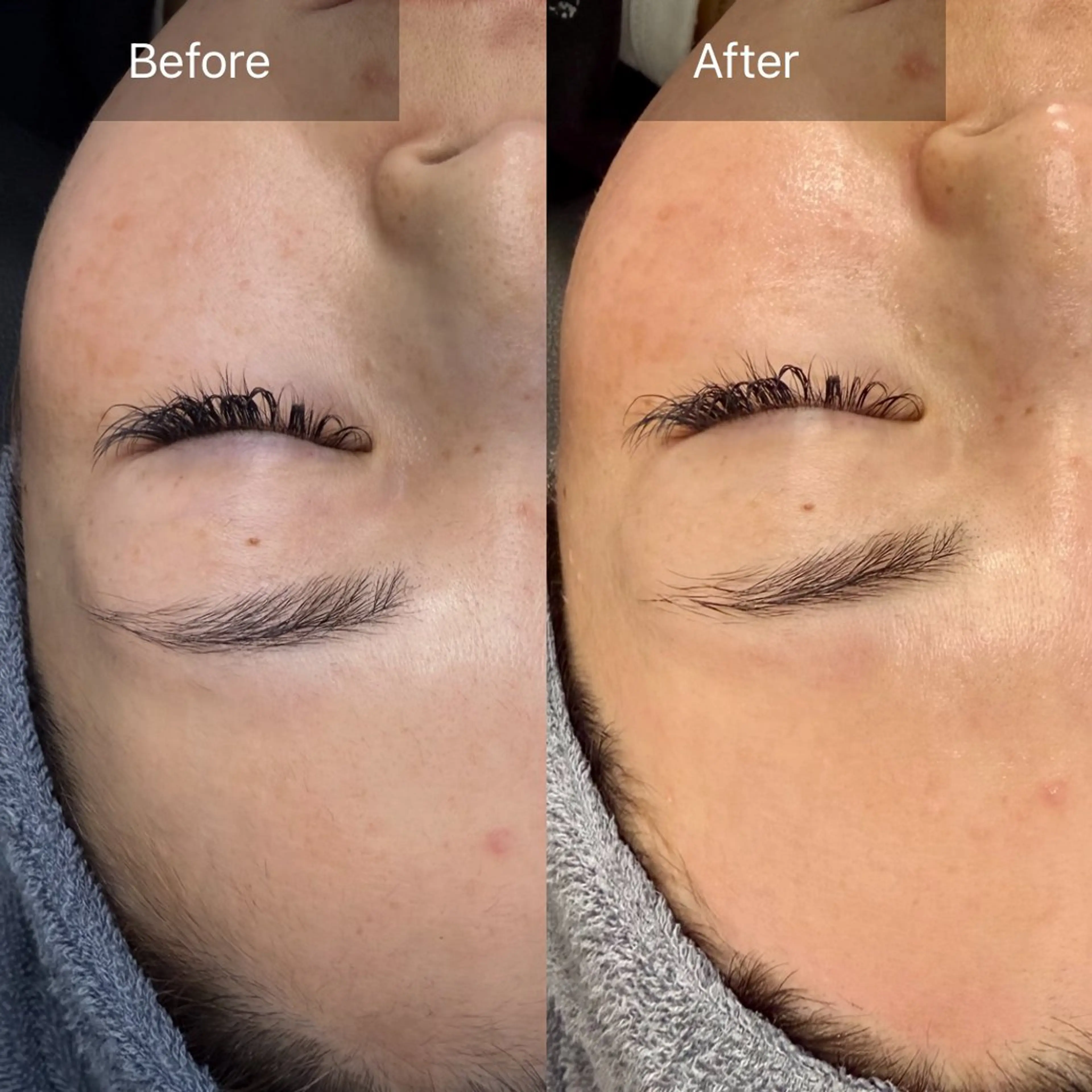 脱毛 enine フェイスWAXのエステ・リラクイメージ