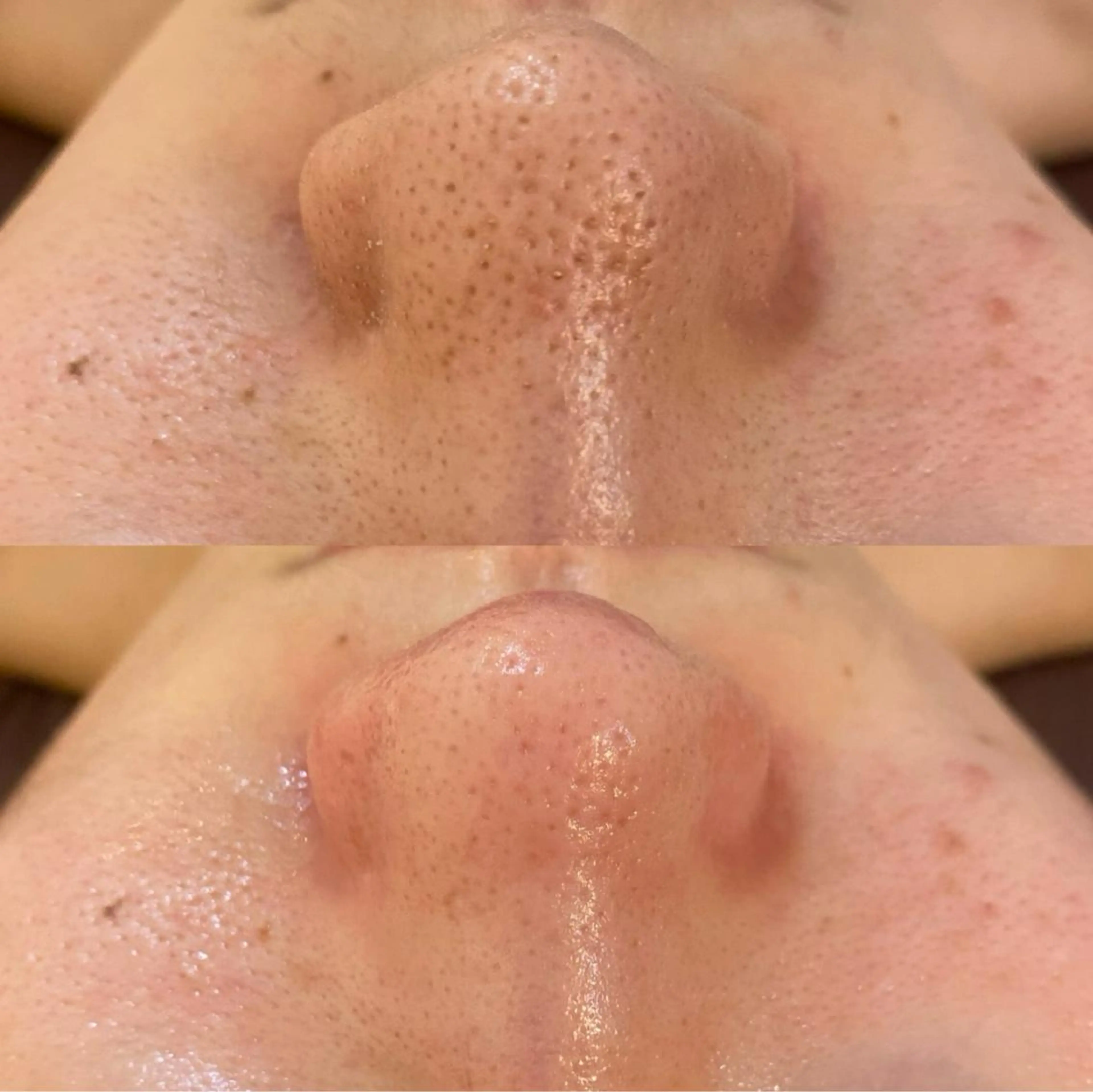 エステ リラク BELCIA福岡店 レコルトデベルシアのエステ・リラクイメージ