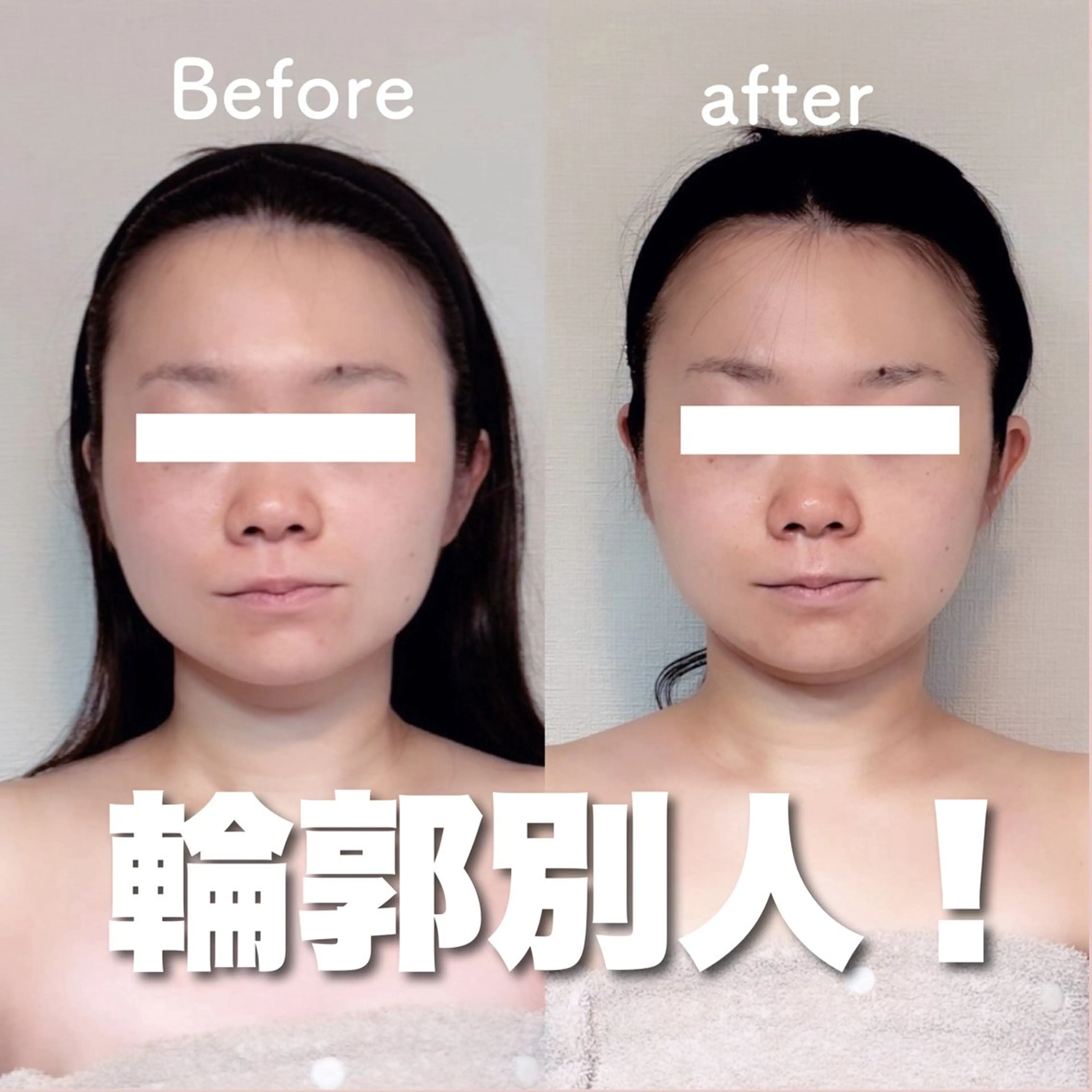 【人気No.1】12/11限定メニュー！整形級小顔へ！！ヘッドスパ＋オーダーメイド小顔矯正＋小顔オイルリンパの写真