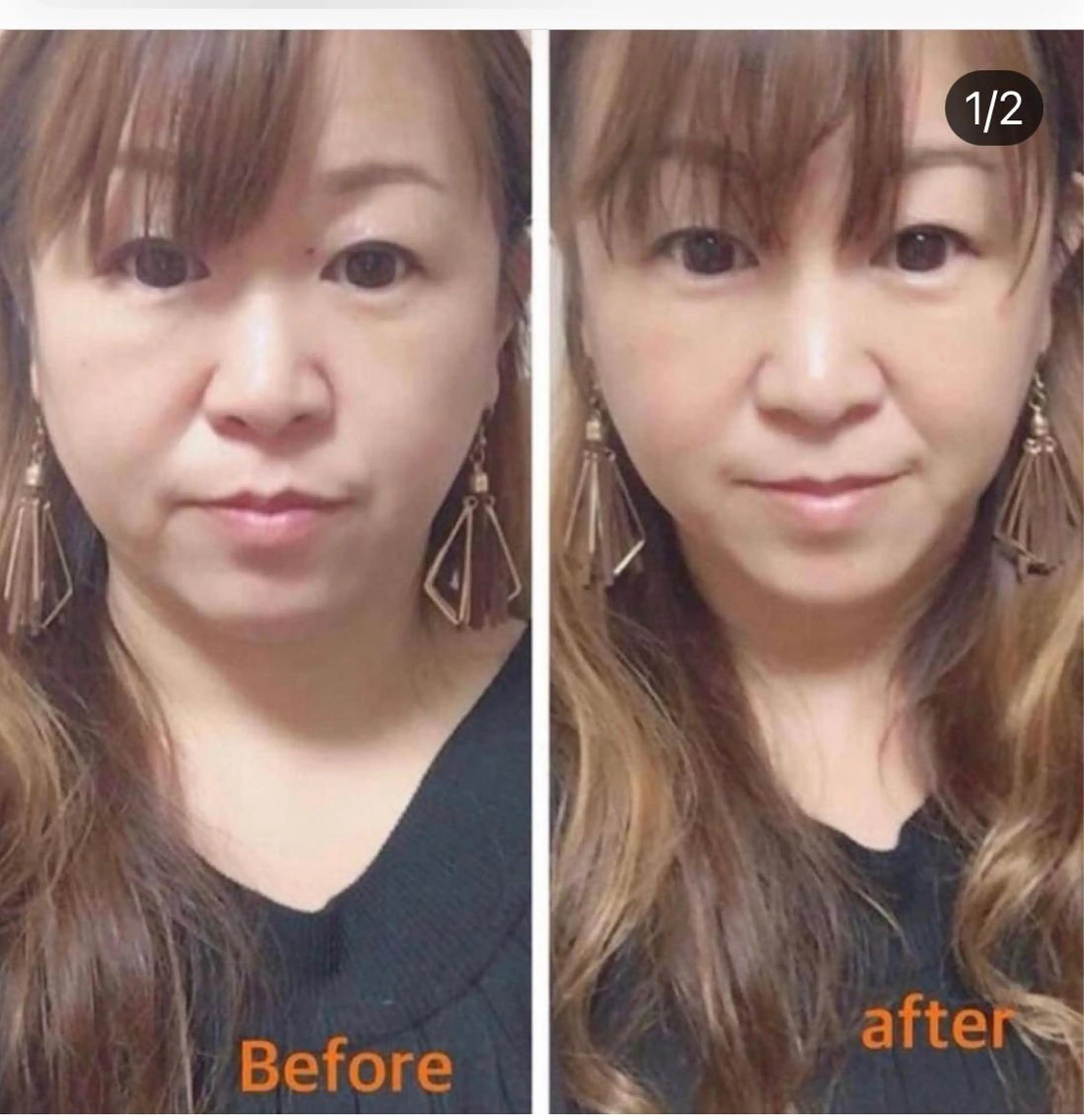 【特別な日の前にオススメコース】頭のてっぺんから足のつま先までひきあげちゃいましょう❤️コースの写真