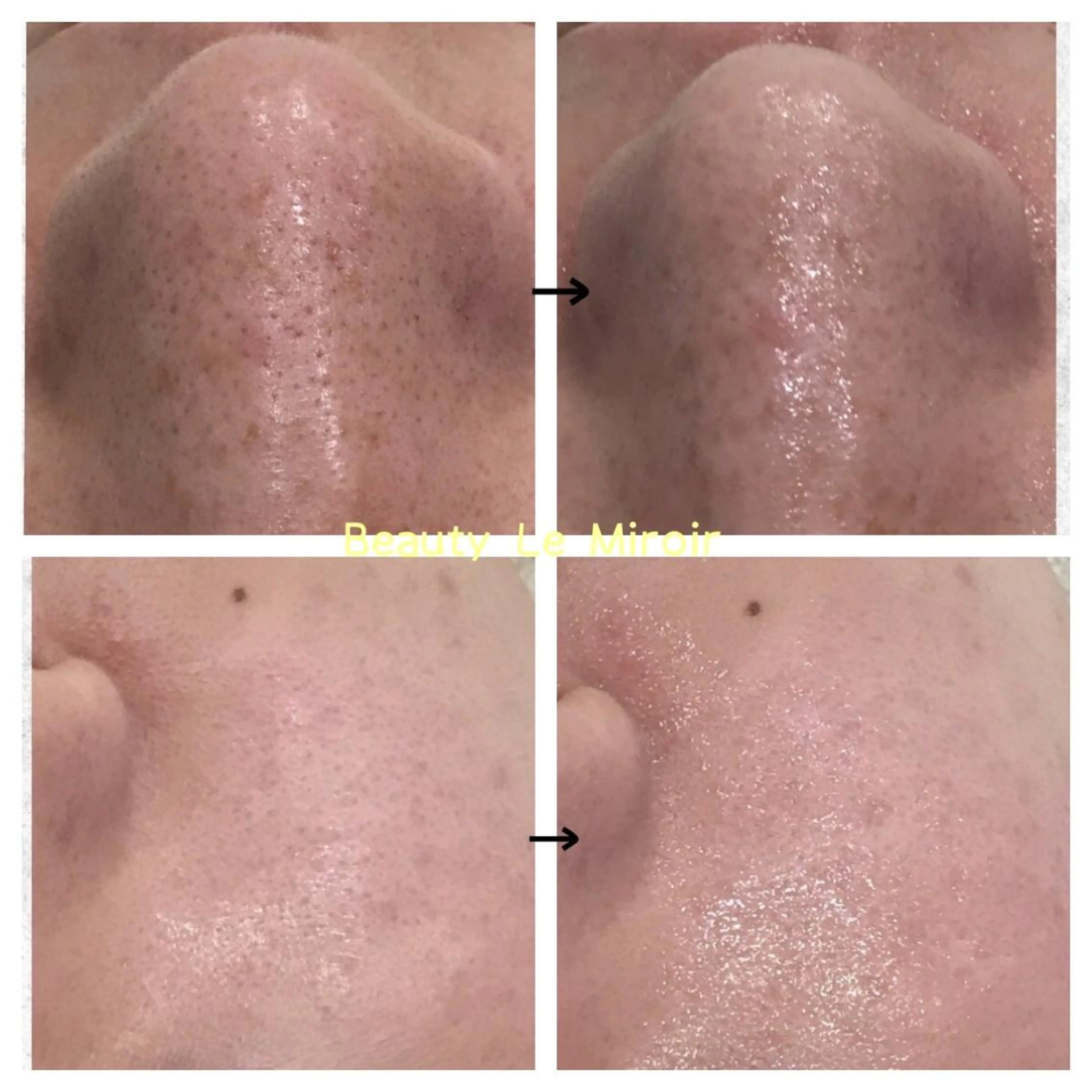 ビューティー ミロワールのエステ・リラクイメージ