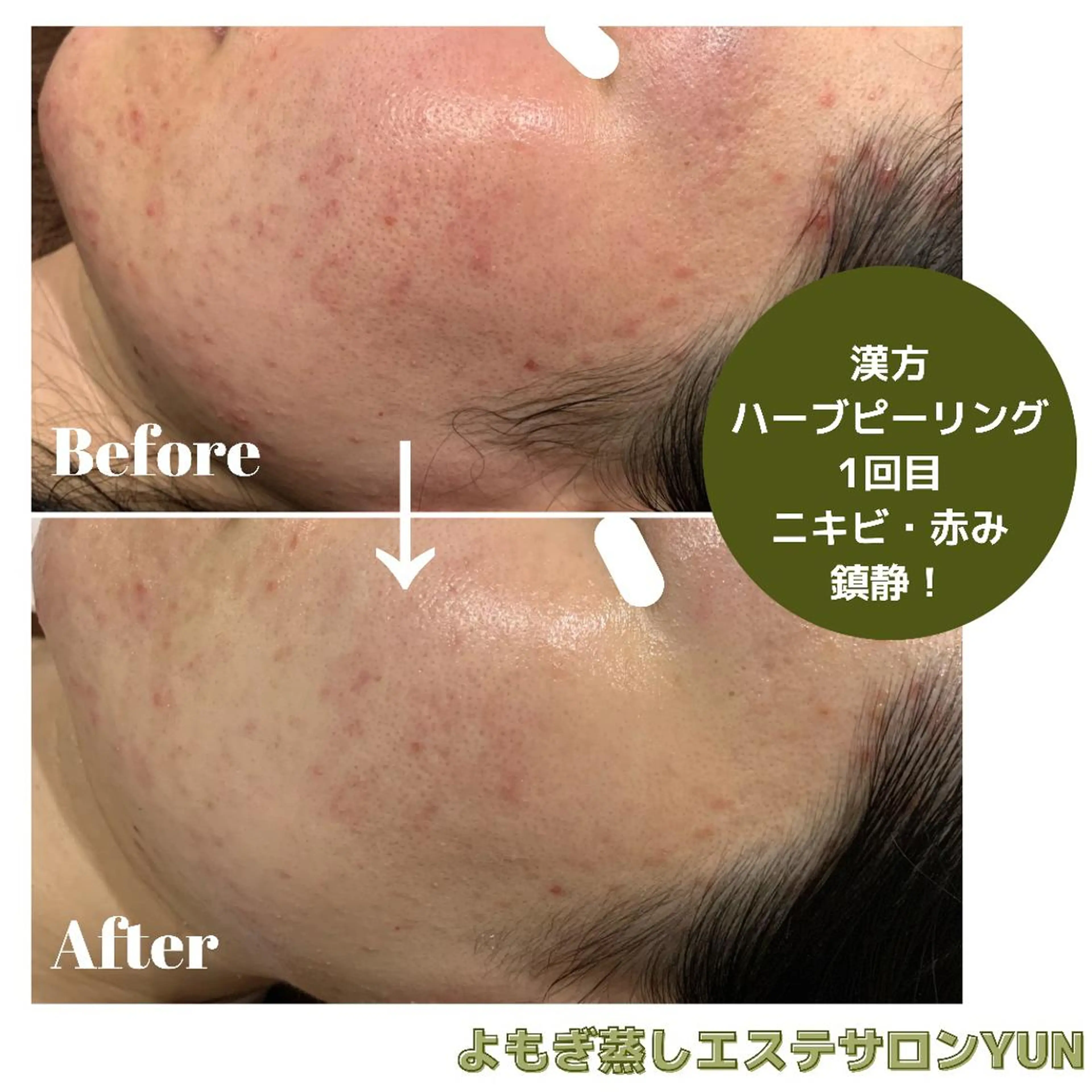 エステ よもぎ蒸しサロン ゆんのエステ・リラクイメージ