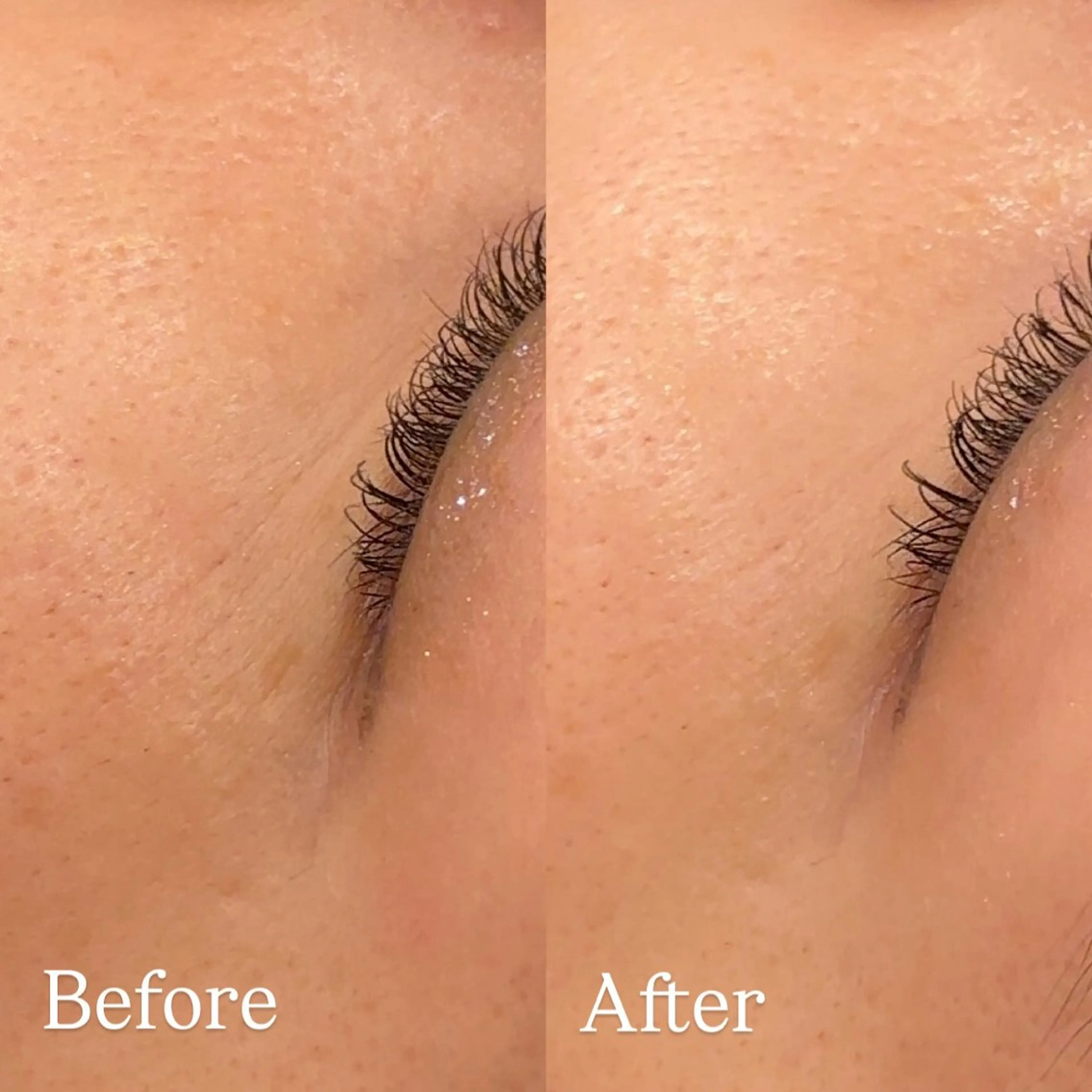 chika🦋 ハリラウンジ恵比寿のエステ・リラクイメージ