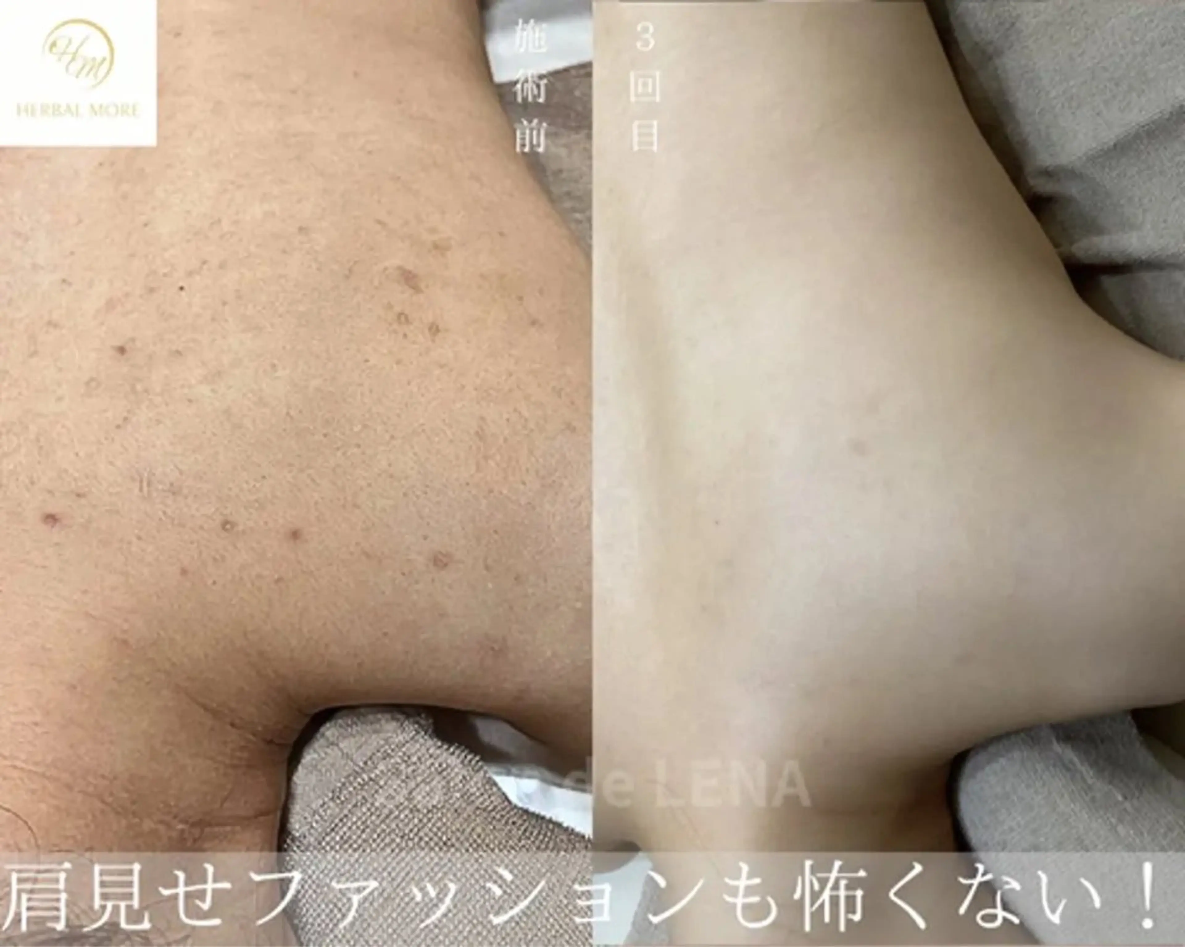 ハーブピーリング専門 グランディール　武内のエステ・リラクイメージ