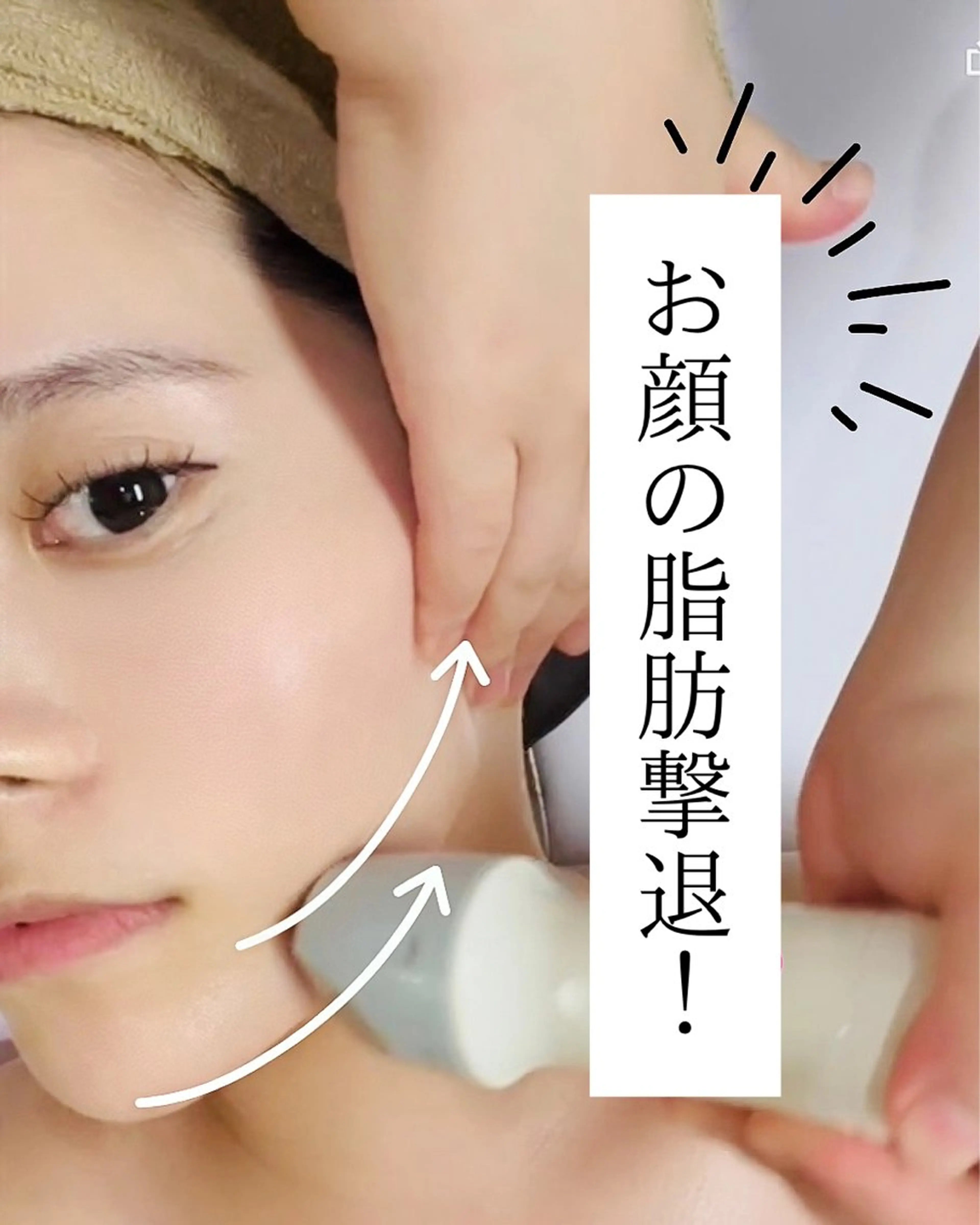 【二重顎・小顔】ラジオフェイシャル¥5,900の写真