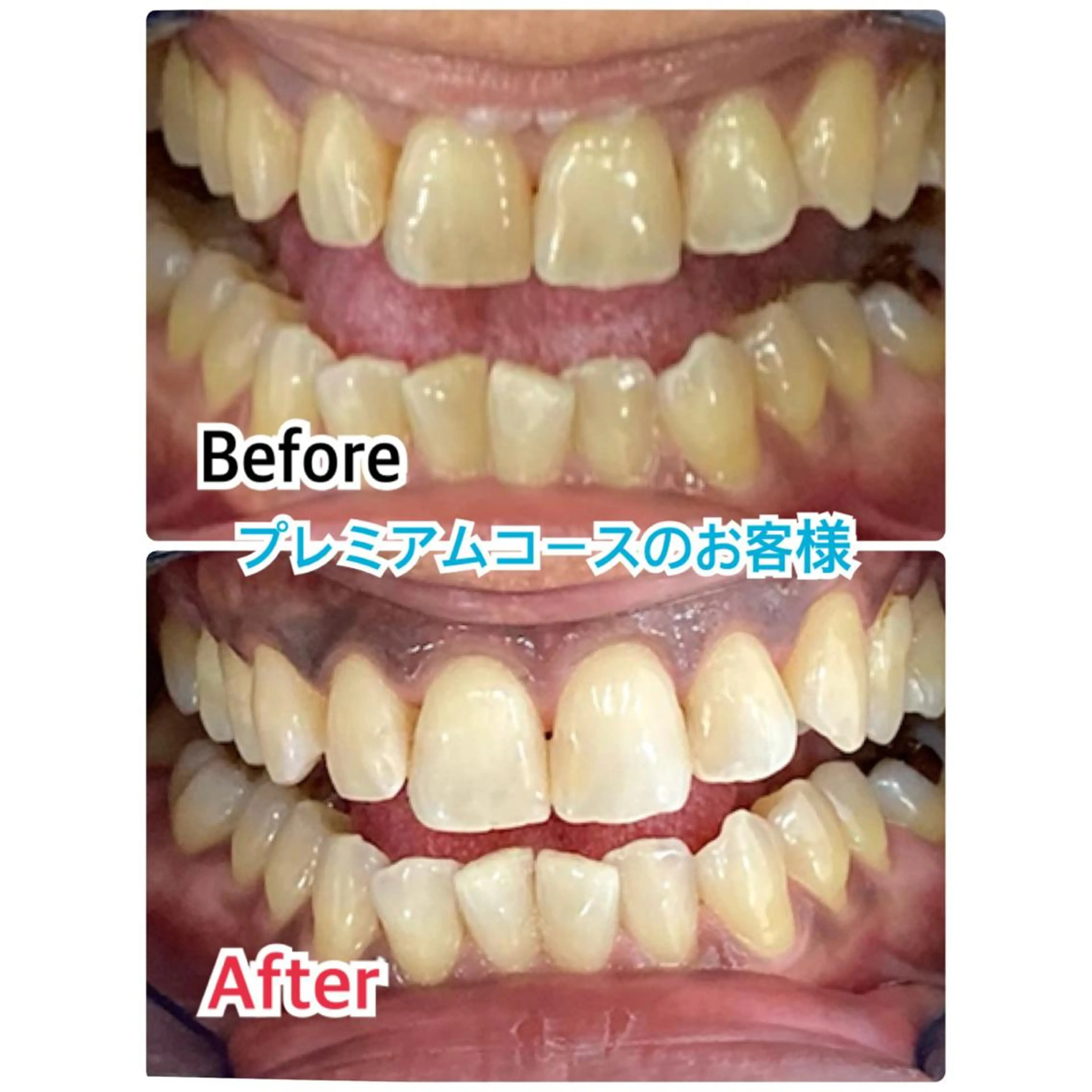 【歯科提携】柏ホワイ トニングスタイルのその他イメージ