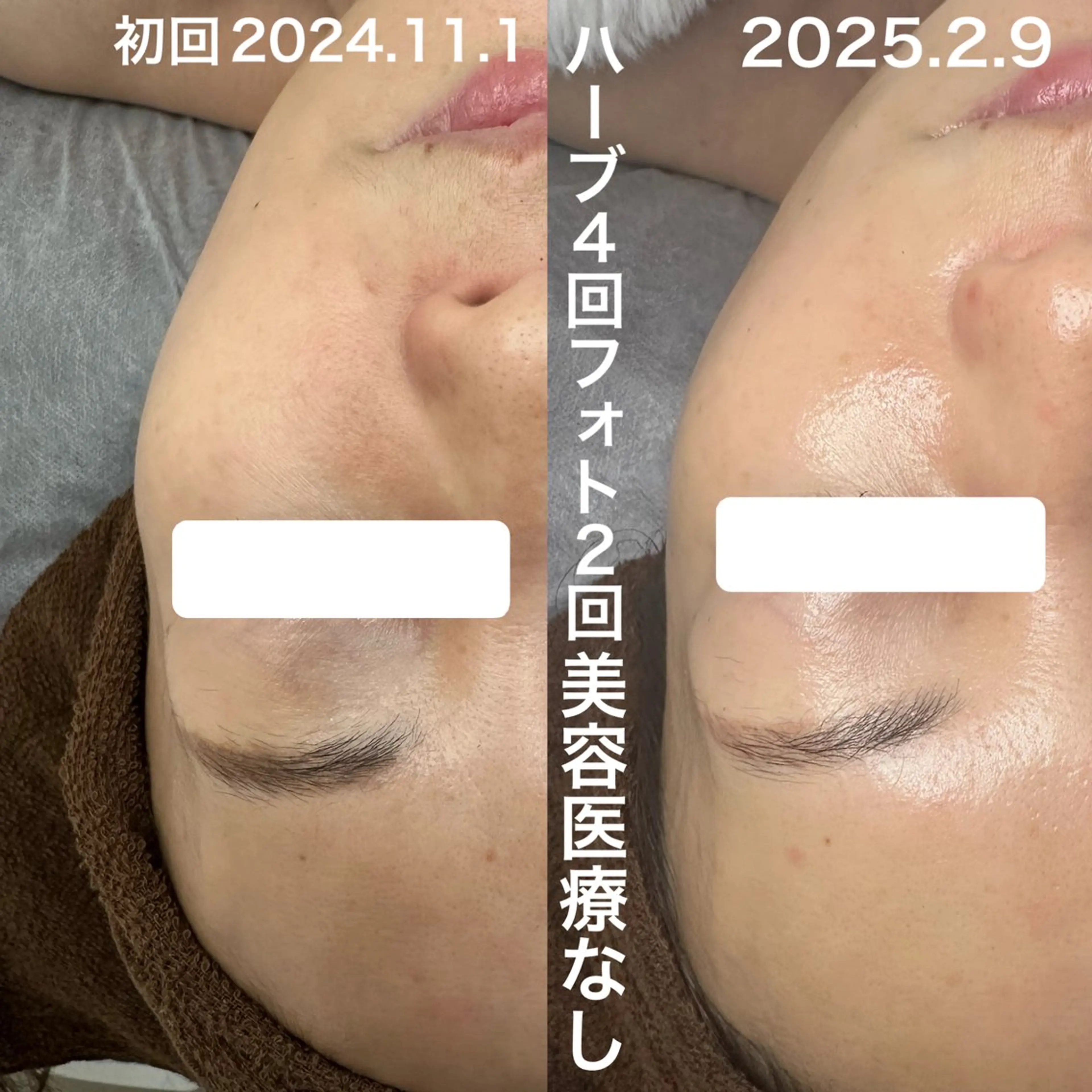 フェイシャルトリートメントの写真