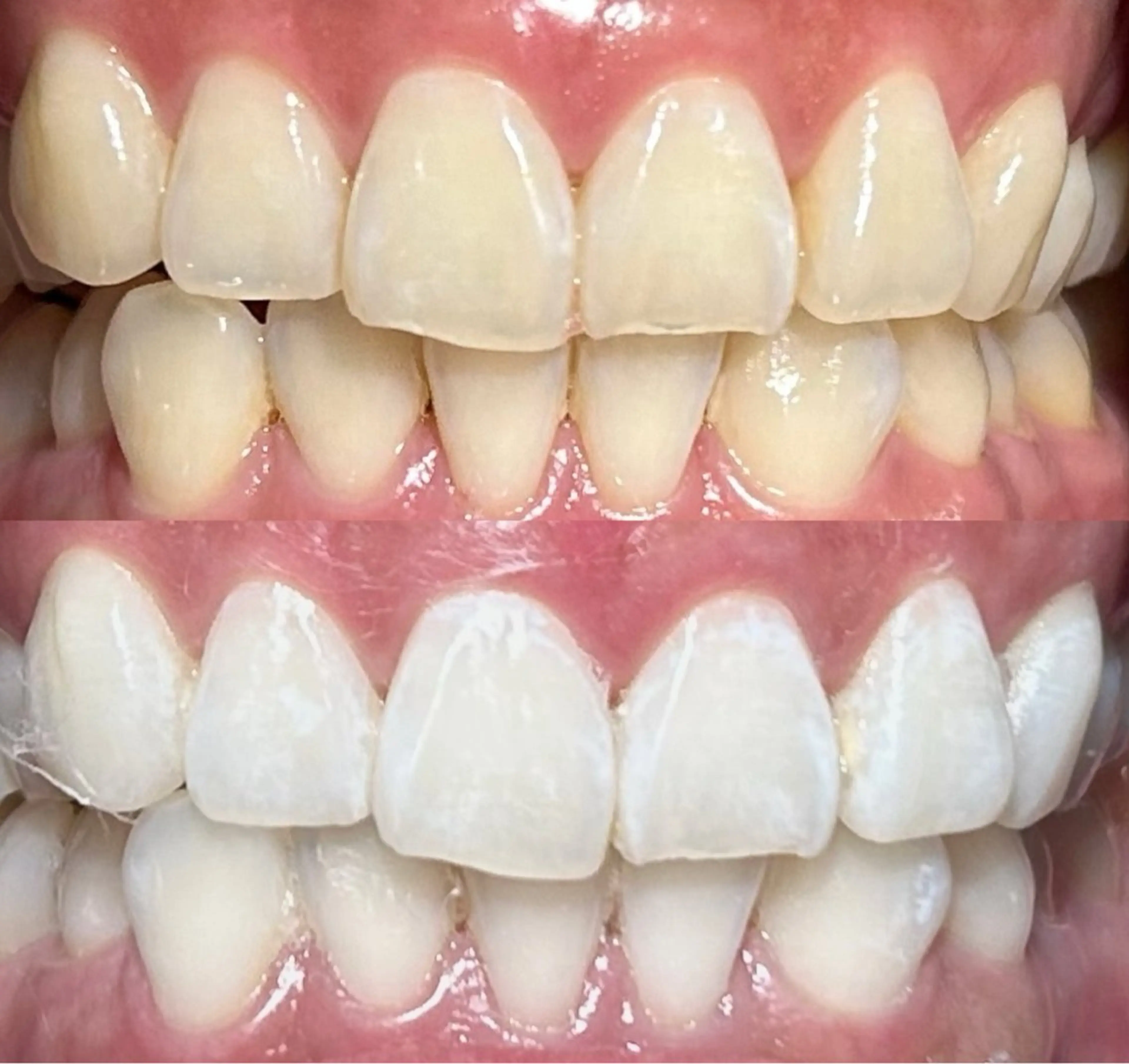 io teeth careのその他イメージ