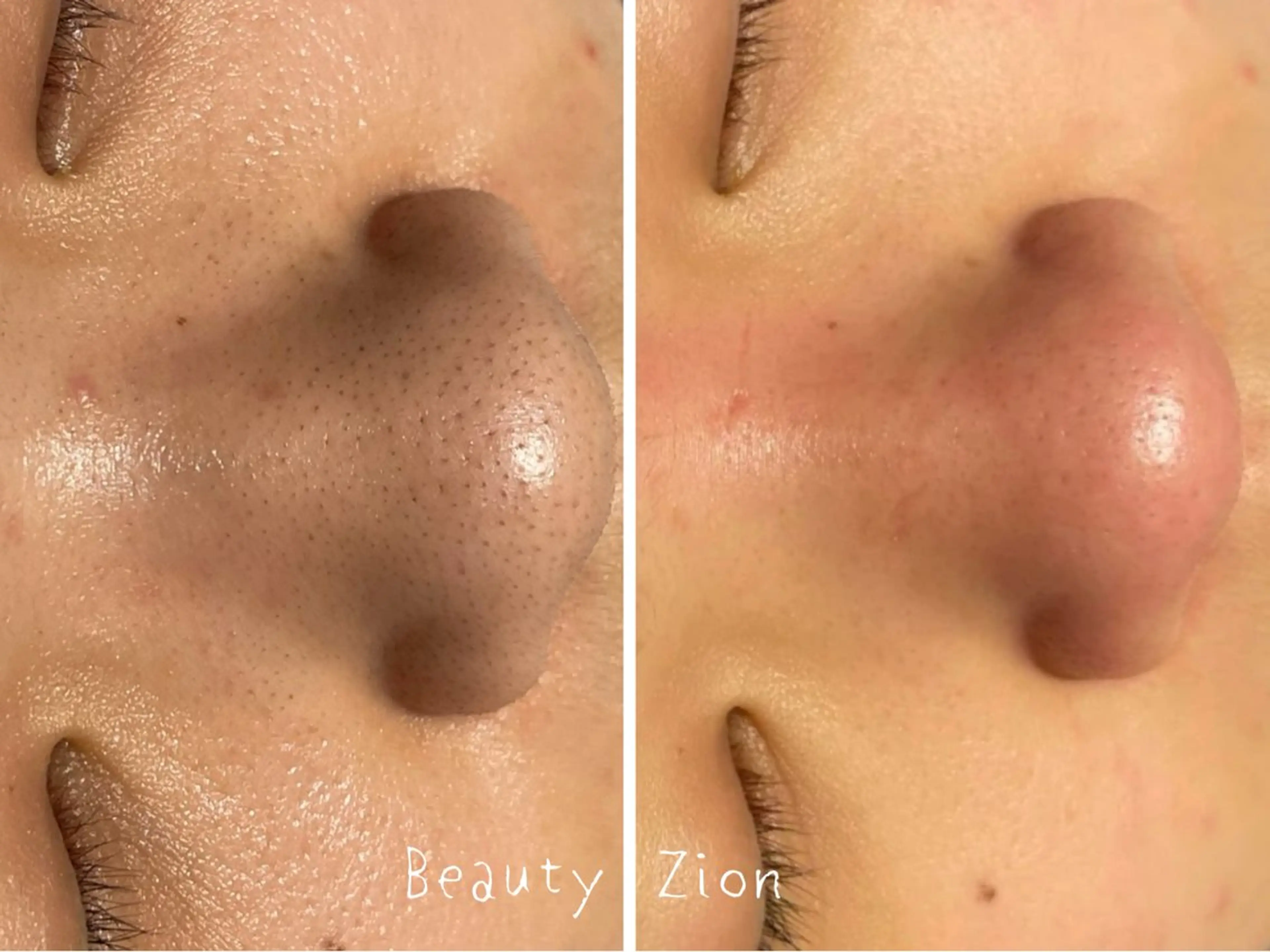 Beauty Zionのエステ・リラクイメージ