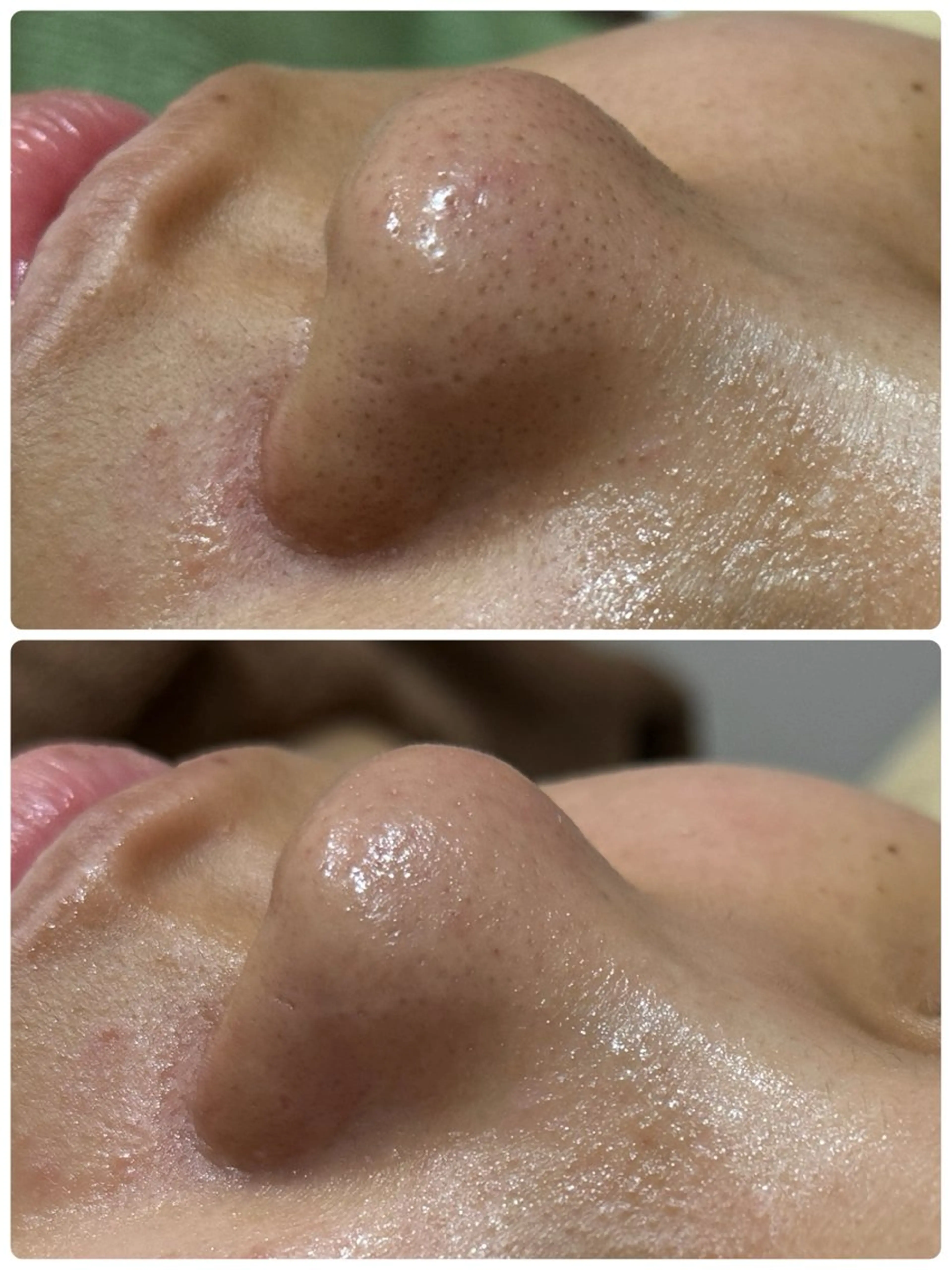 エステ 脱毛&フェイシャル 専門店muro.のエステ・リラクイメージ