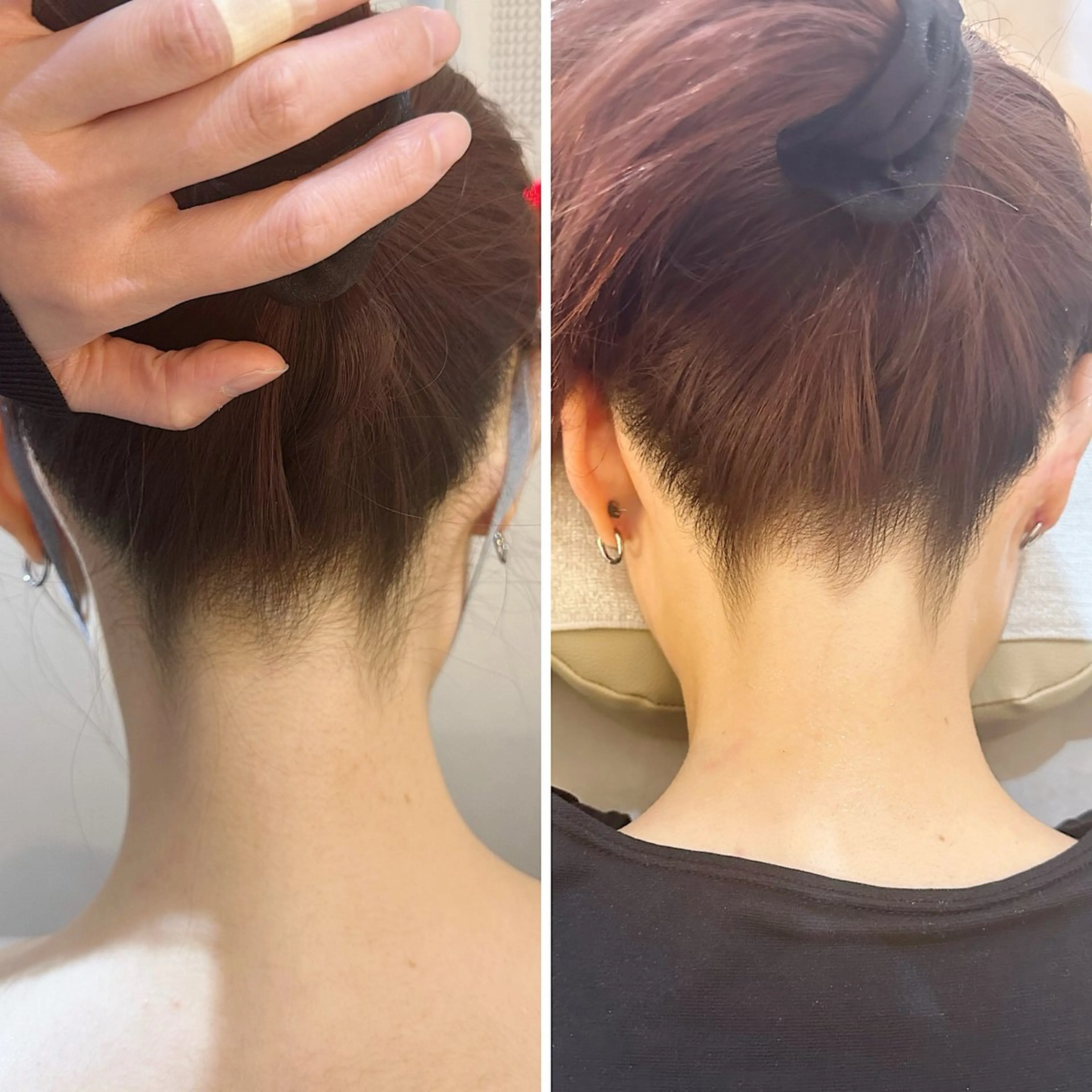 脱毛 うなじ脱毛/美肌脱毛 LABELのエステ・リラクイメージ