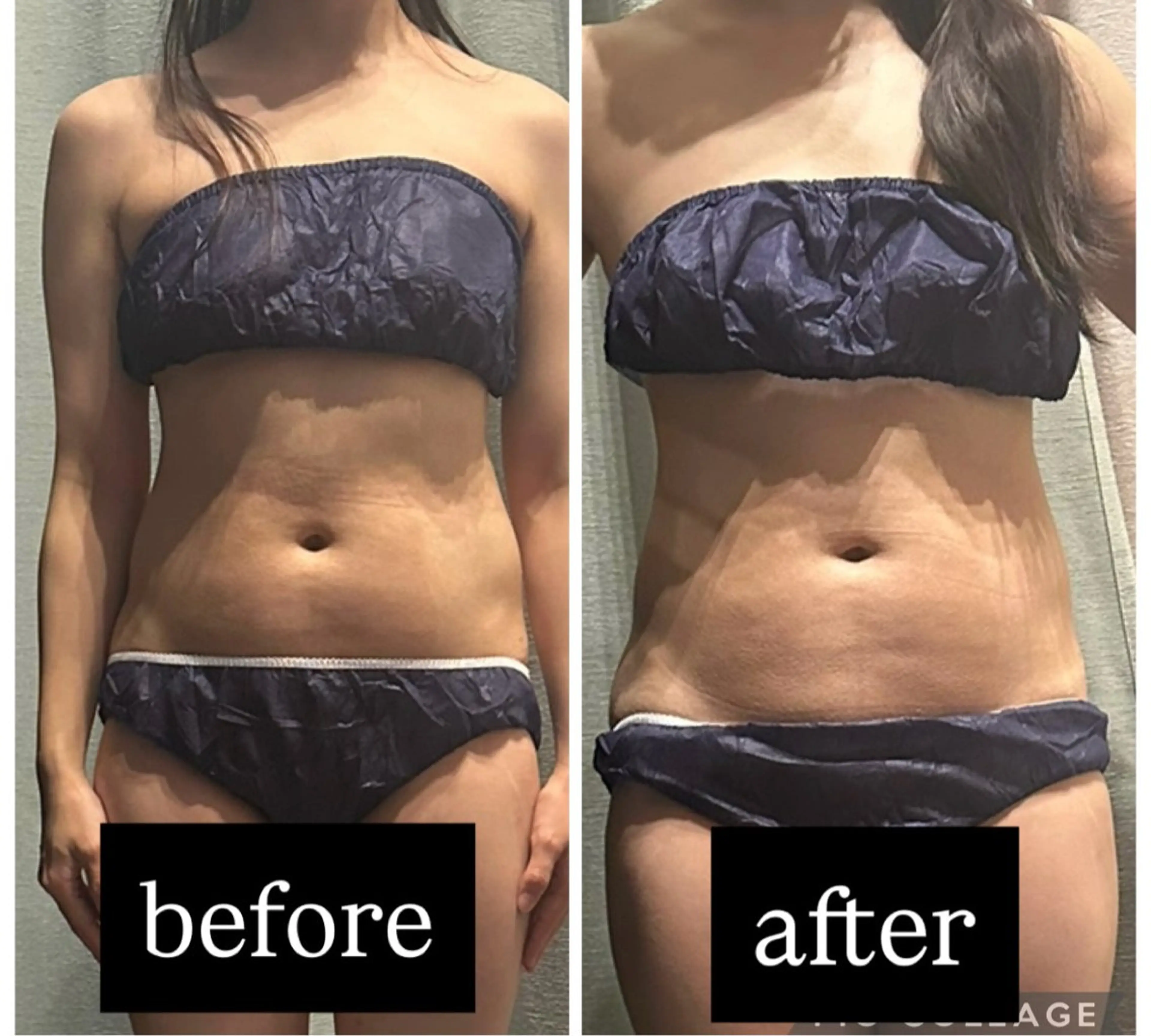 エステ 浮腫|肩こり|張り 日々の疲れを解消★のエステ・リラクイメージ