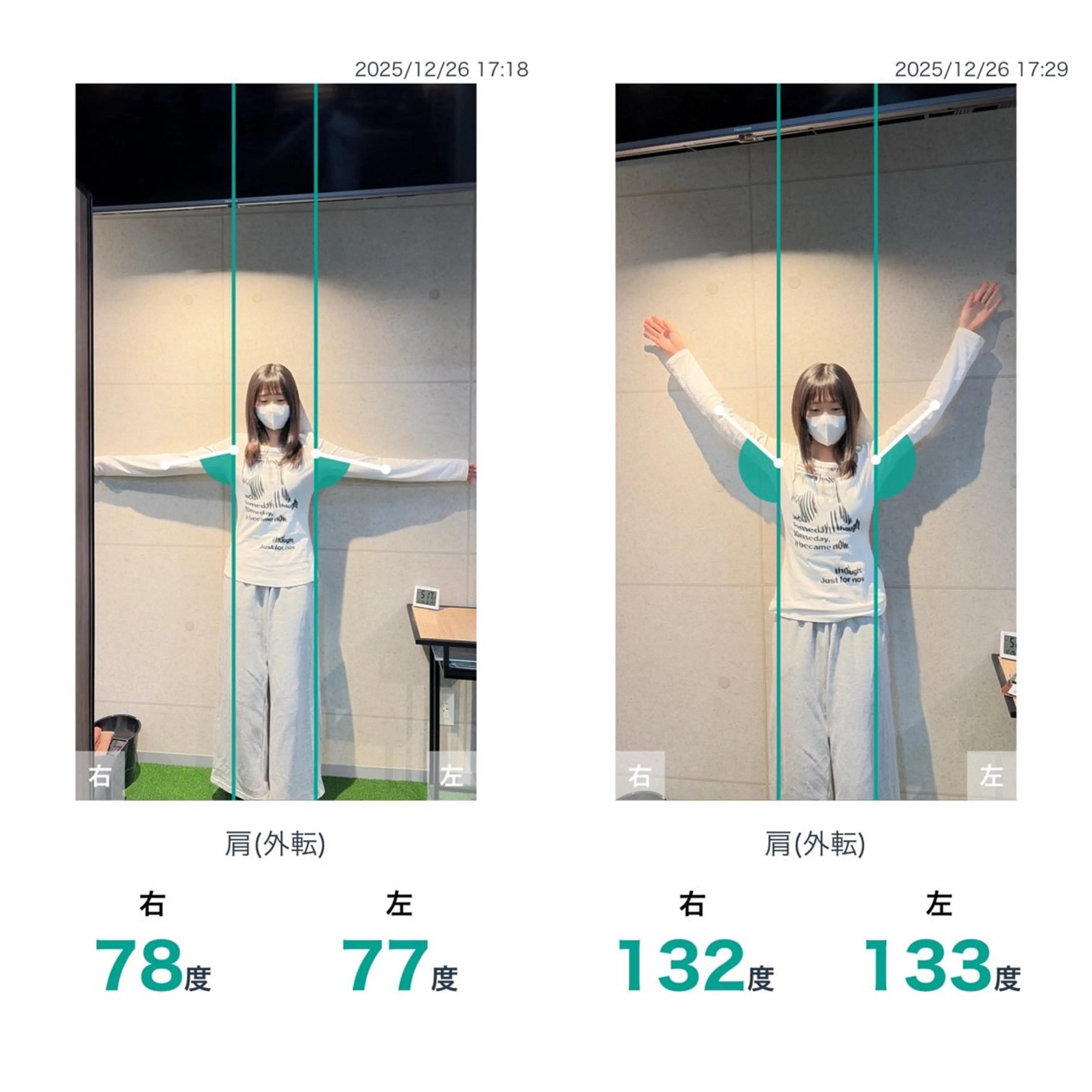 健康×美容鍼鍼灸院 あさば整体院三ノ輪店のエステ・リラクイメージ