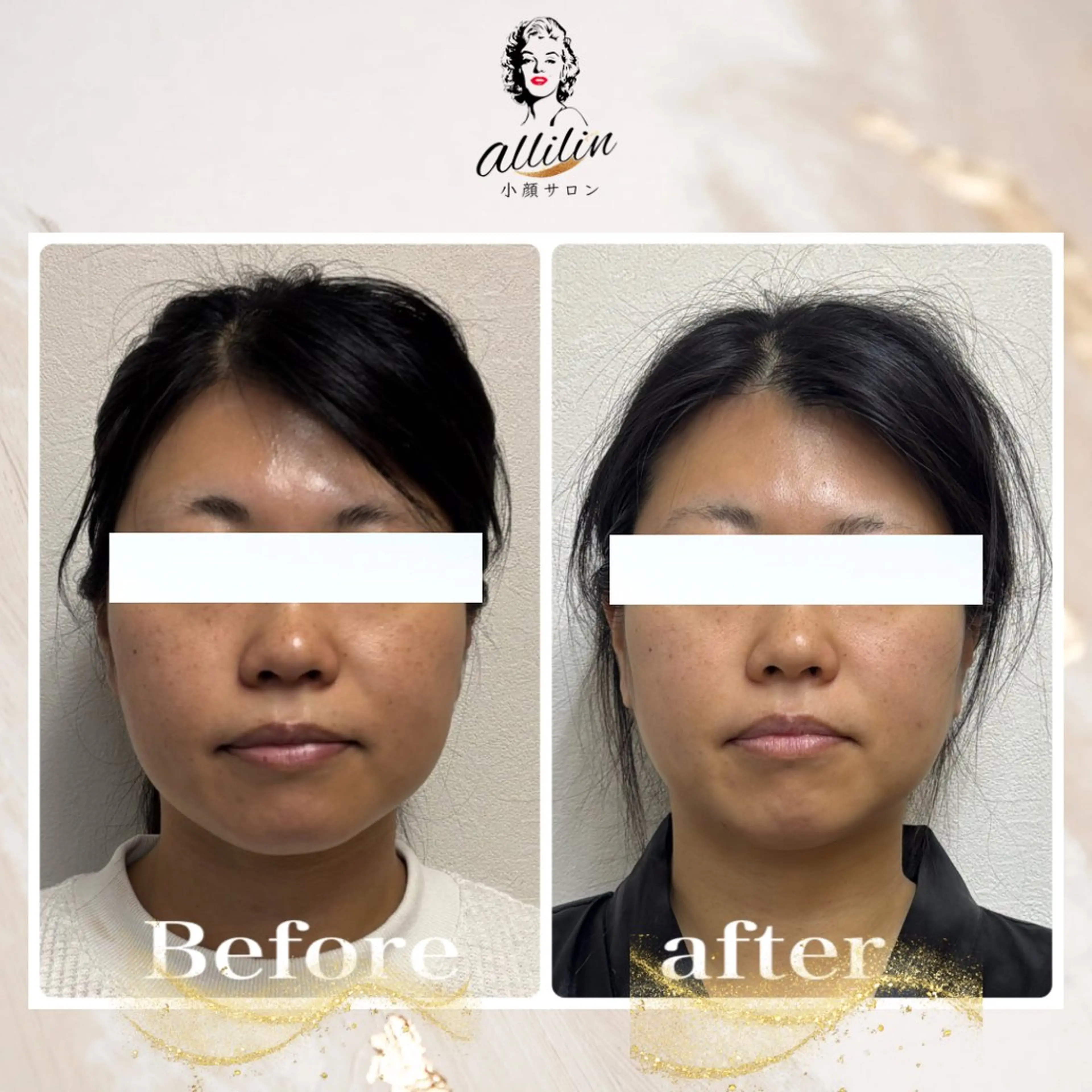 💎allilin 五所川原💎本間のエステ・リラクイメージ