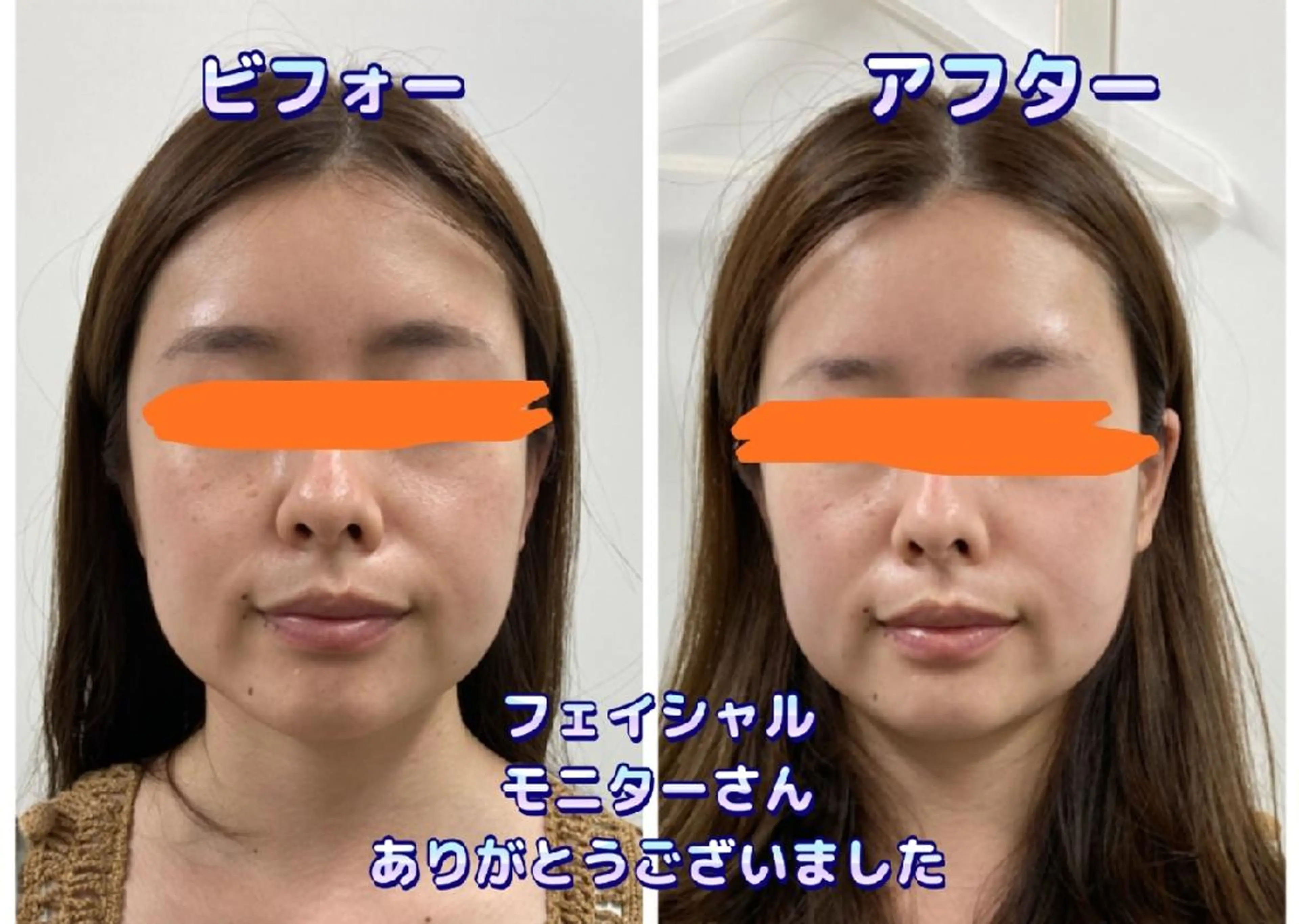 ショールームエステbeco所属・ショールームエステ becoのエステ・リラクイメージ