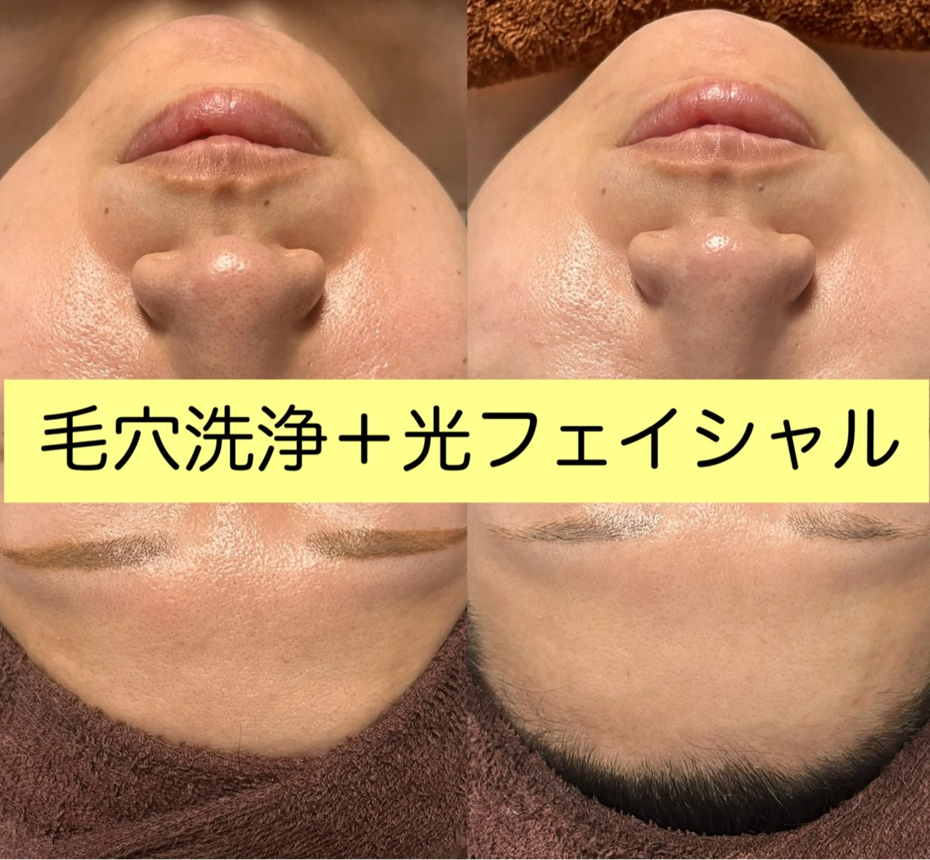 エステ 毛穴洗浄🍀脱毛🍀 光フェイシャル🍀のエステ・リラクイメージ