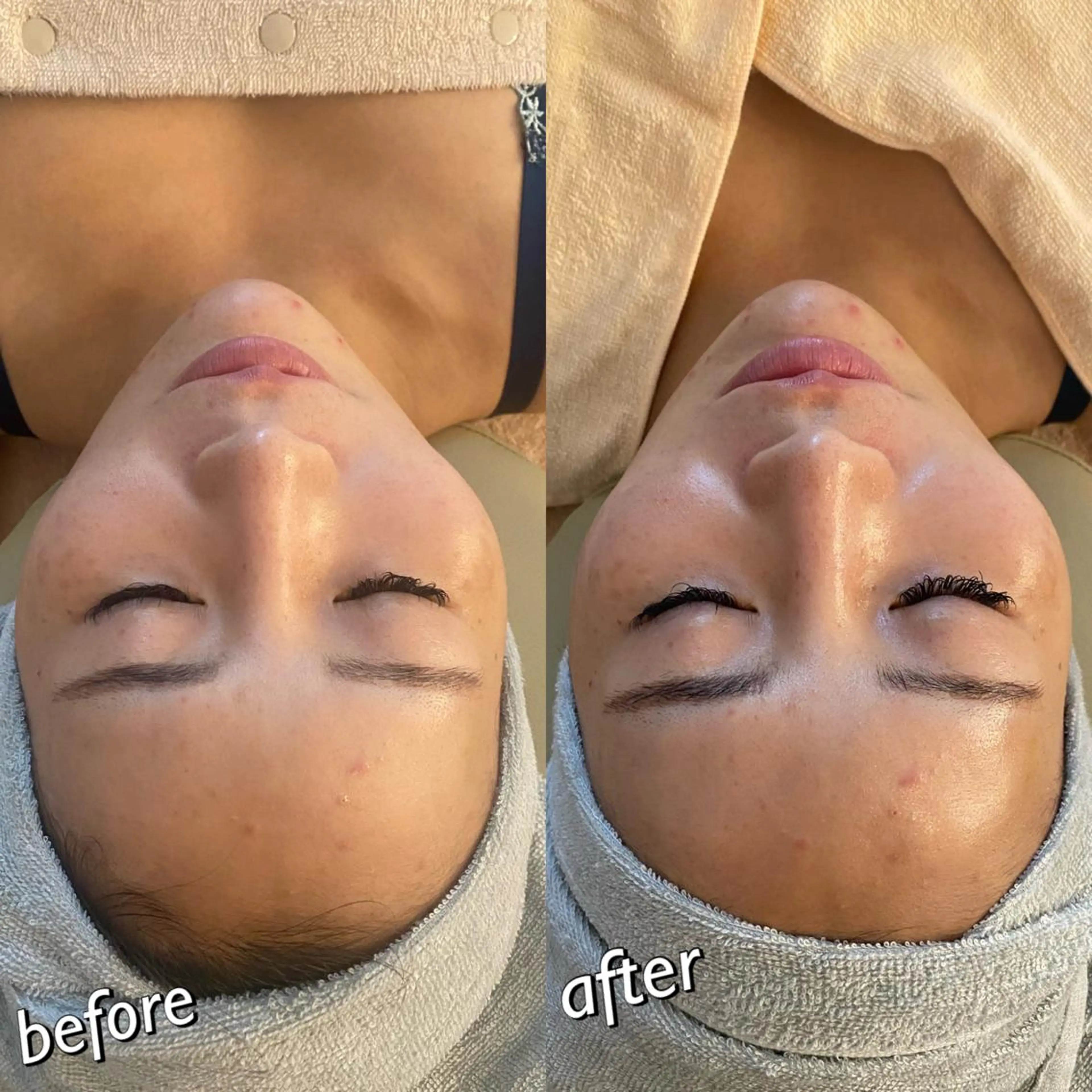 うなじ脱毛/美肌脱毛 LABELのエステ・リラクイメージ