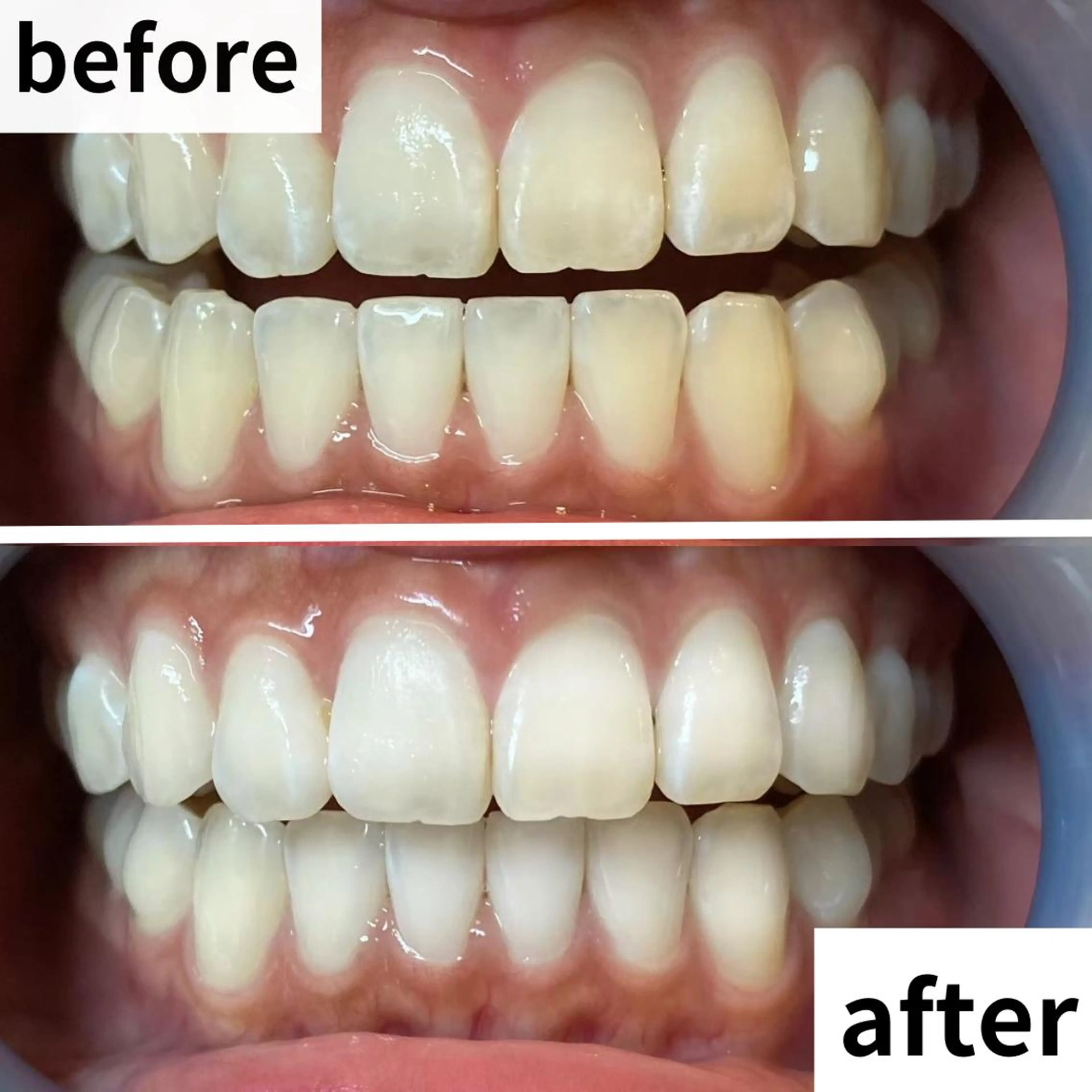 エステ リラク LBSホワイトニング 🌐渋谷店 河内のエステ・リラクイメージ