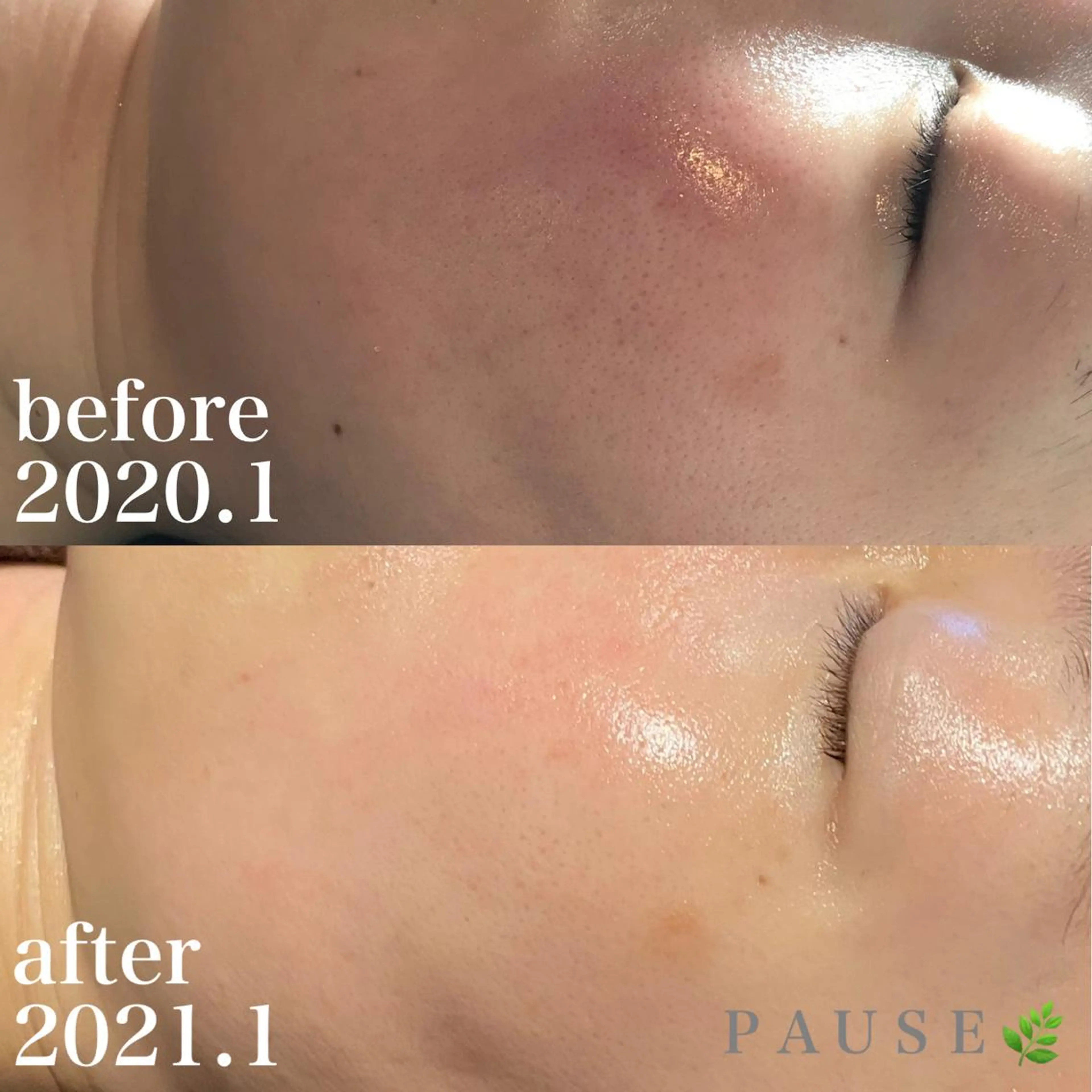 エステ 浜野 恵美のエステ・リラクイメージ