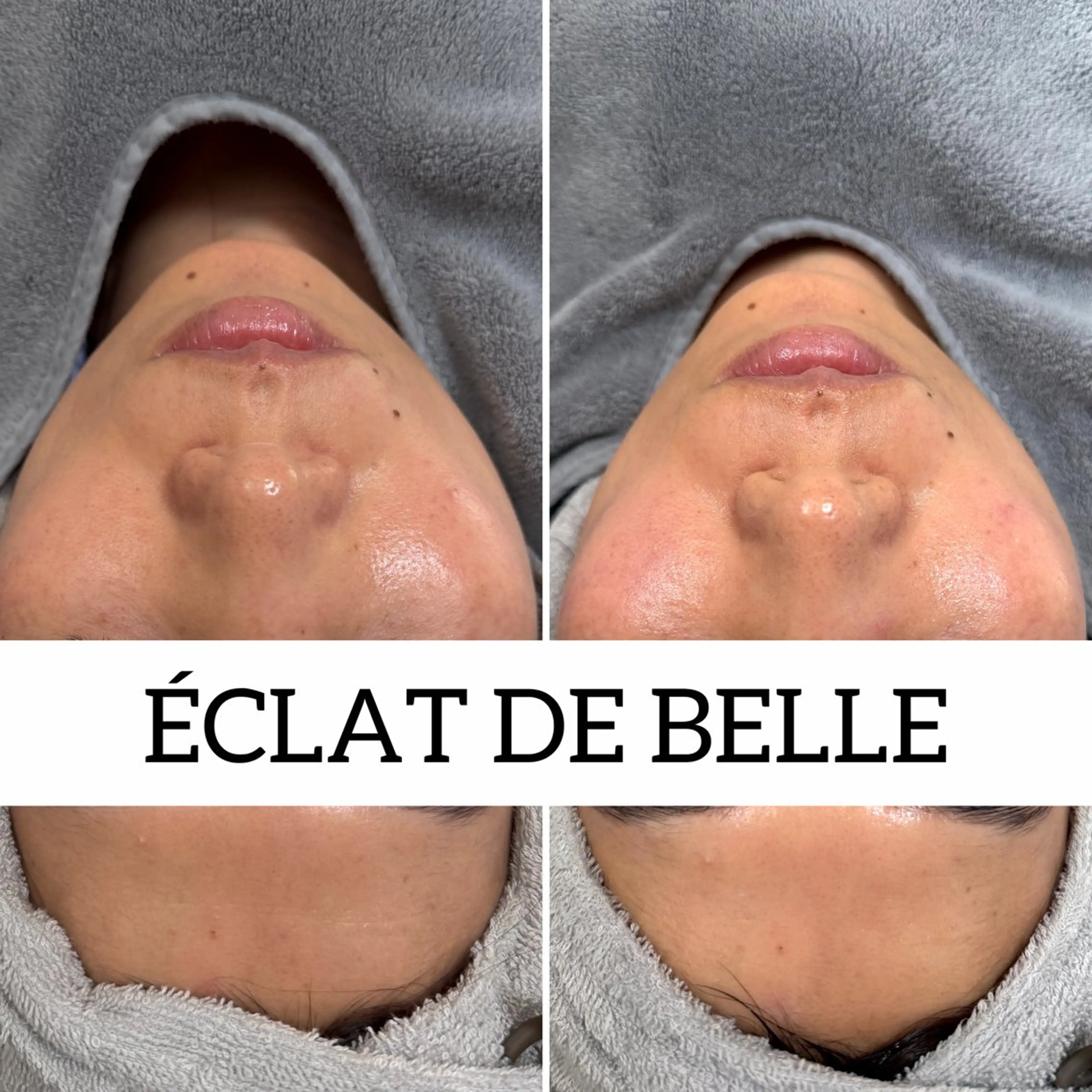 その他 Éclat de Belle🫧白玉肌のその他イメージ