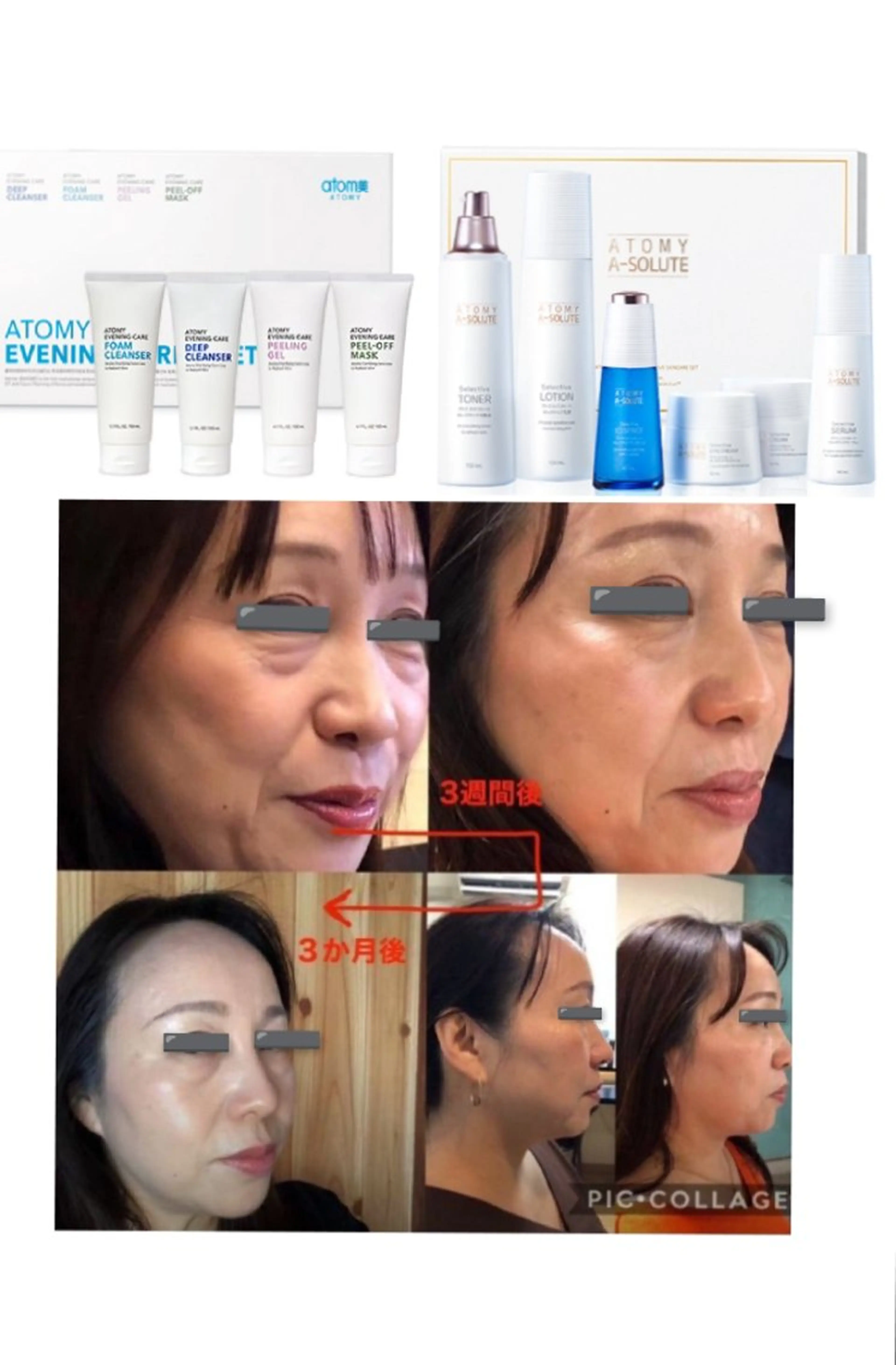 【自宅用スキンケア＆高級化粧品含む】マイナス10歳を目指す方の基本エステコースの写真