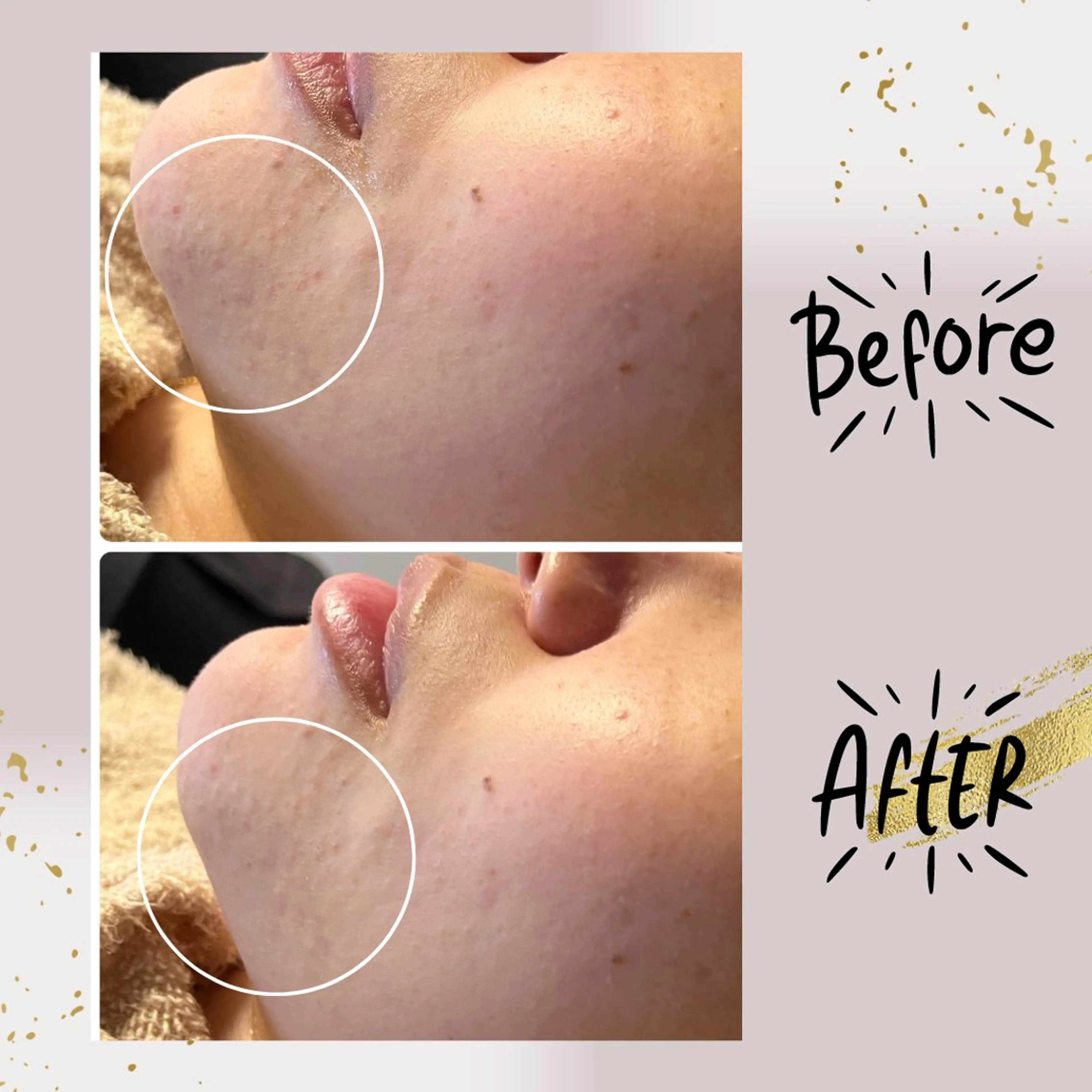 エステ リラク ピーリング専門店 Belluteのエステ・リラクイメージ