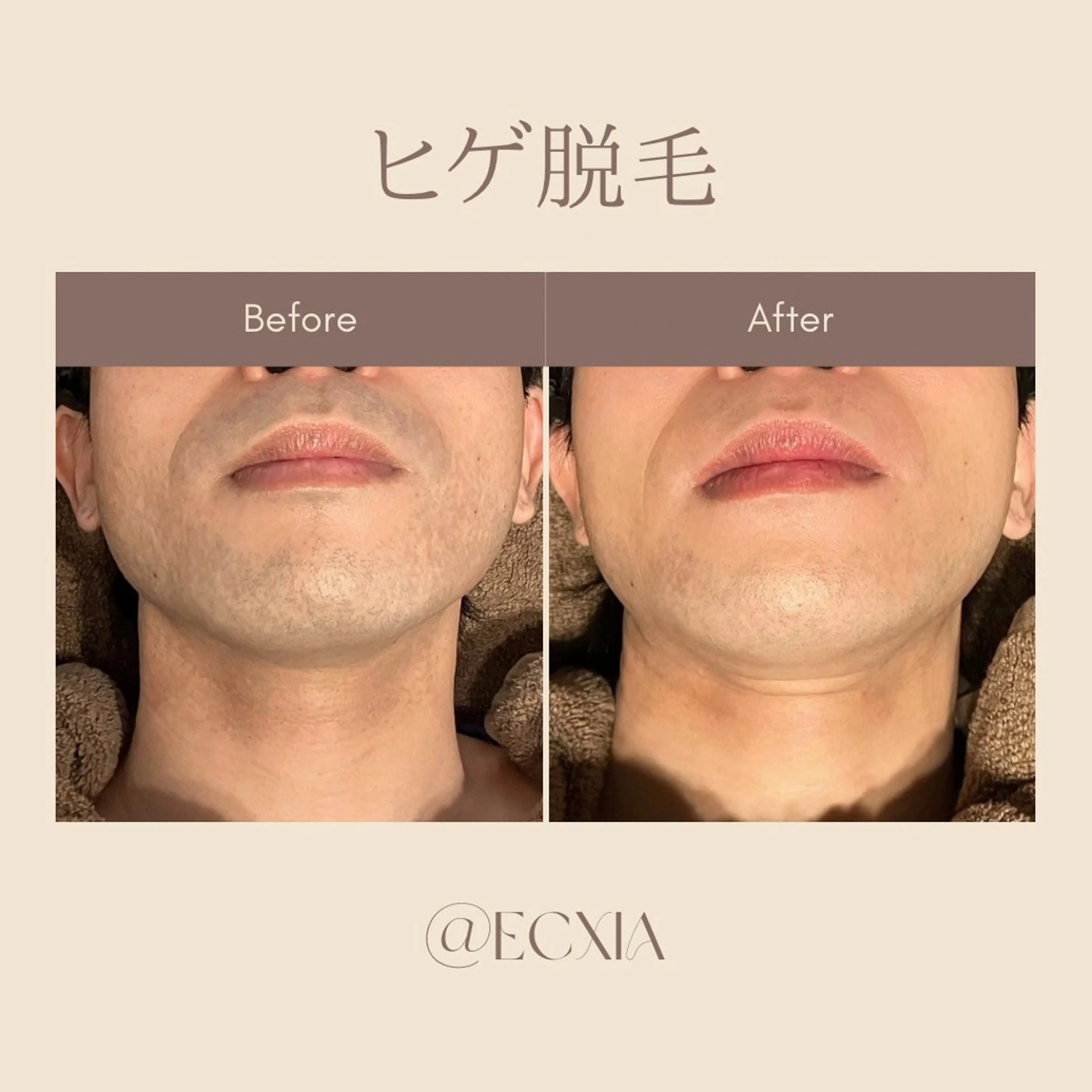 メンズ メンズ脱毛サロン ECXIA 博多のエステ・リラクイメージ
