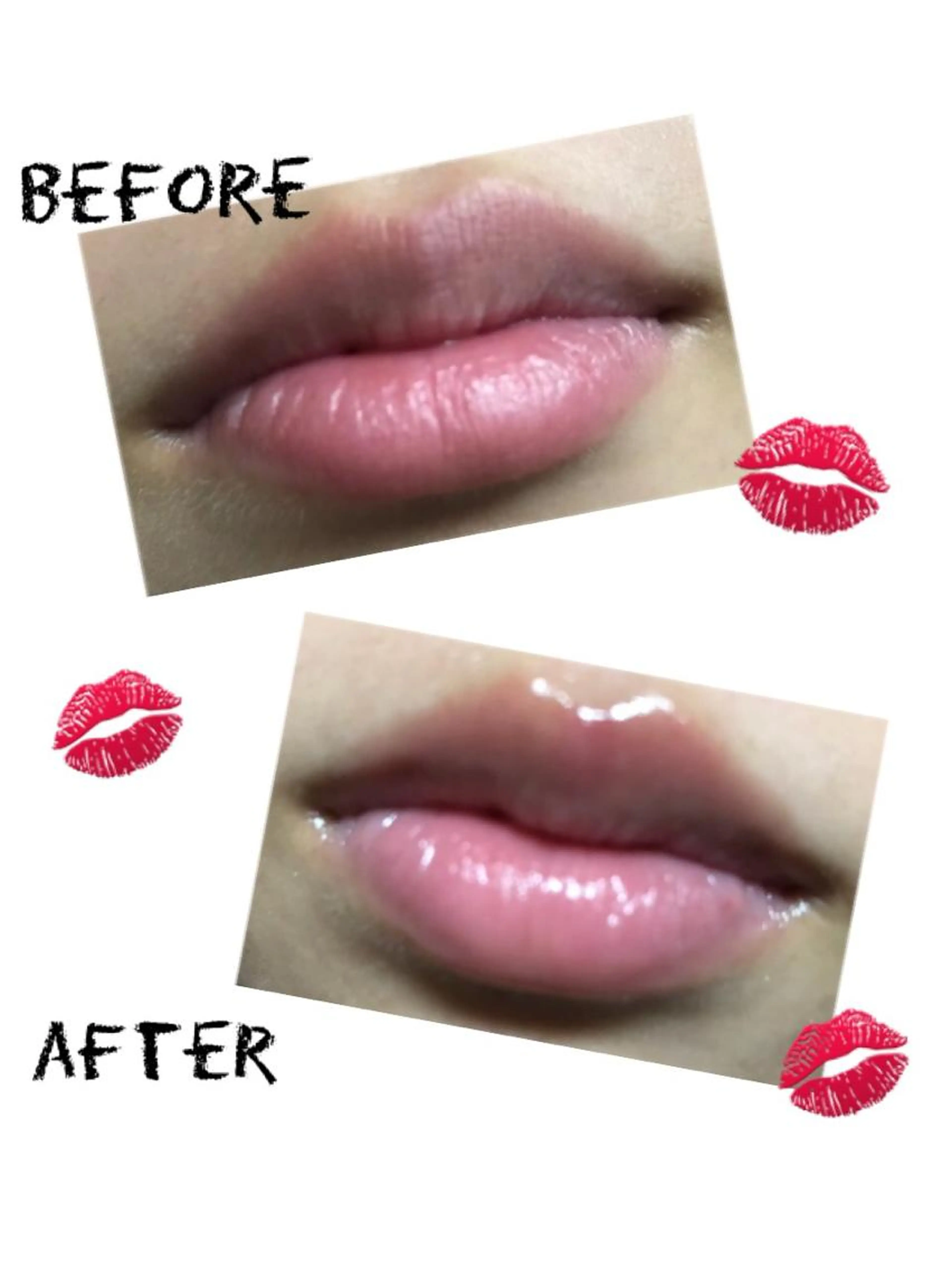 ✨💋リップエステ💋✨の写真