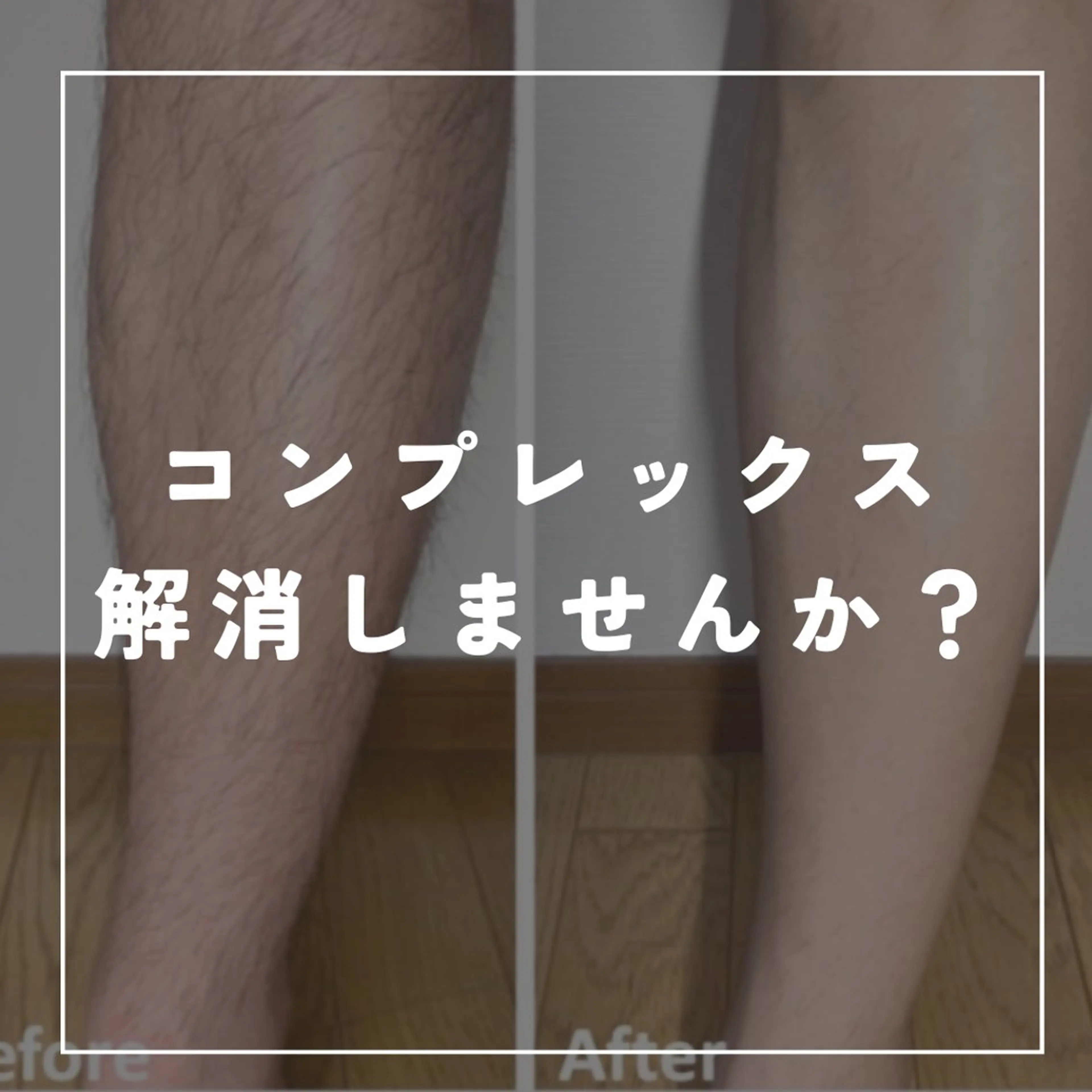 脱毛 脱毛/痩身/頭皮ケア GLYCINEのエステ・リラクイメージ