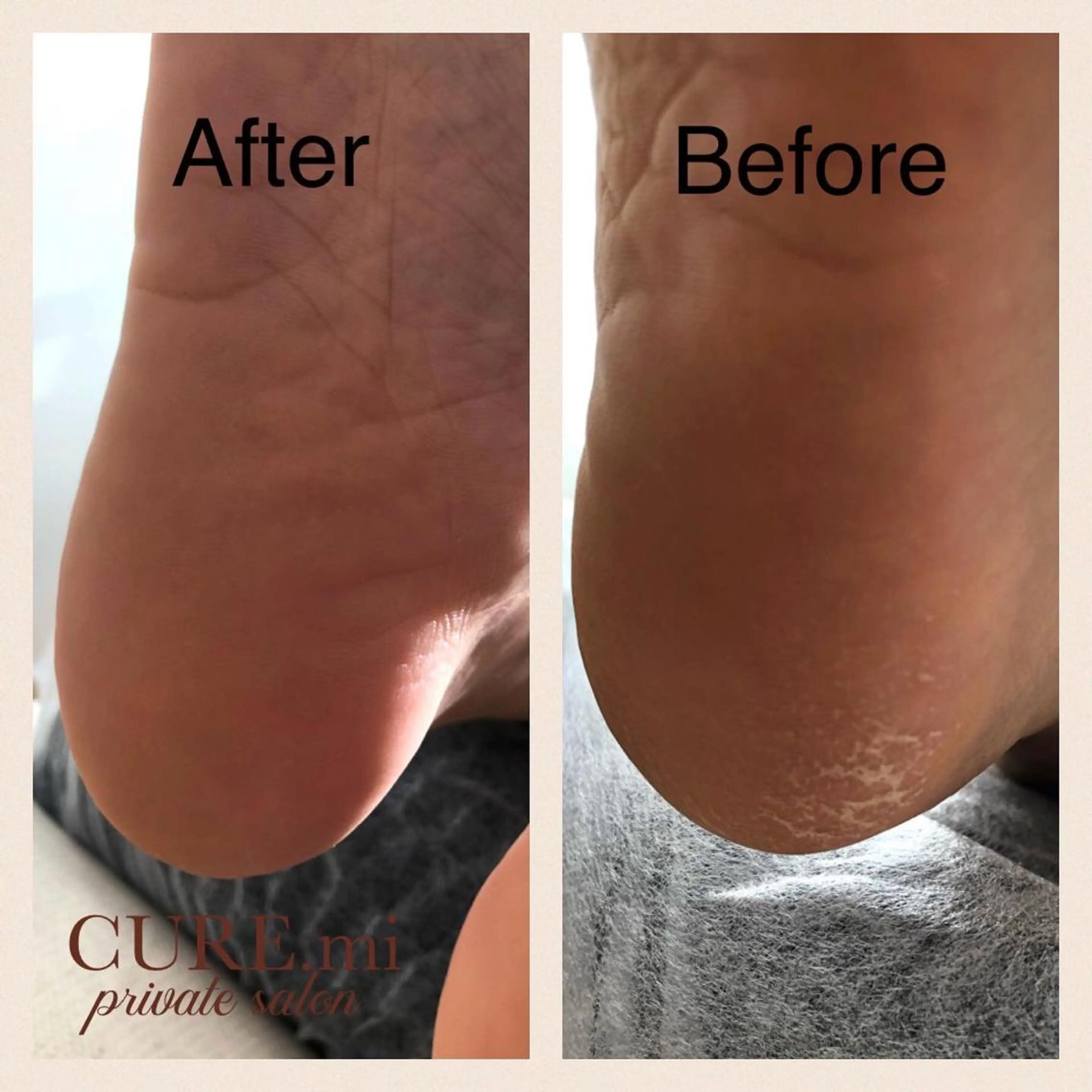 ネイル フットネイル 伊藤 美香のその他イメージ