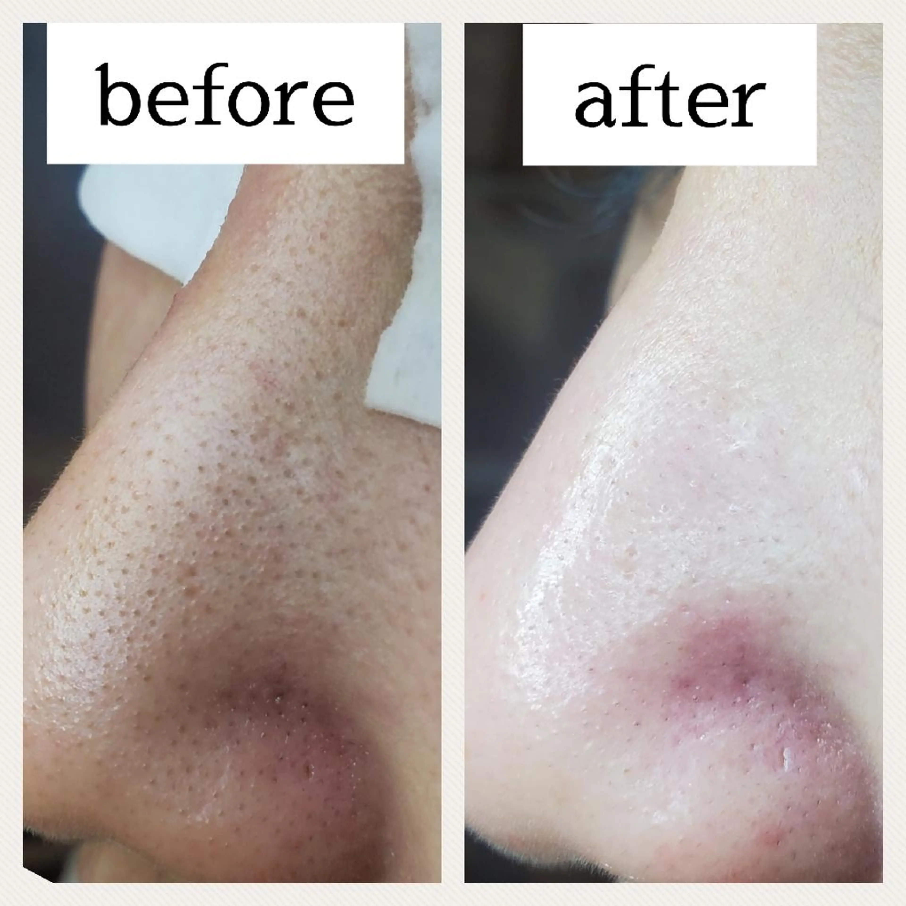 毛穴専門店 マカナアロハのエステ・リラクイメージ