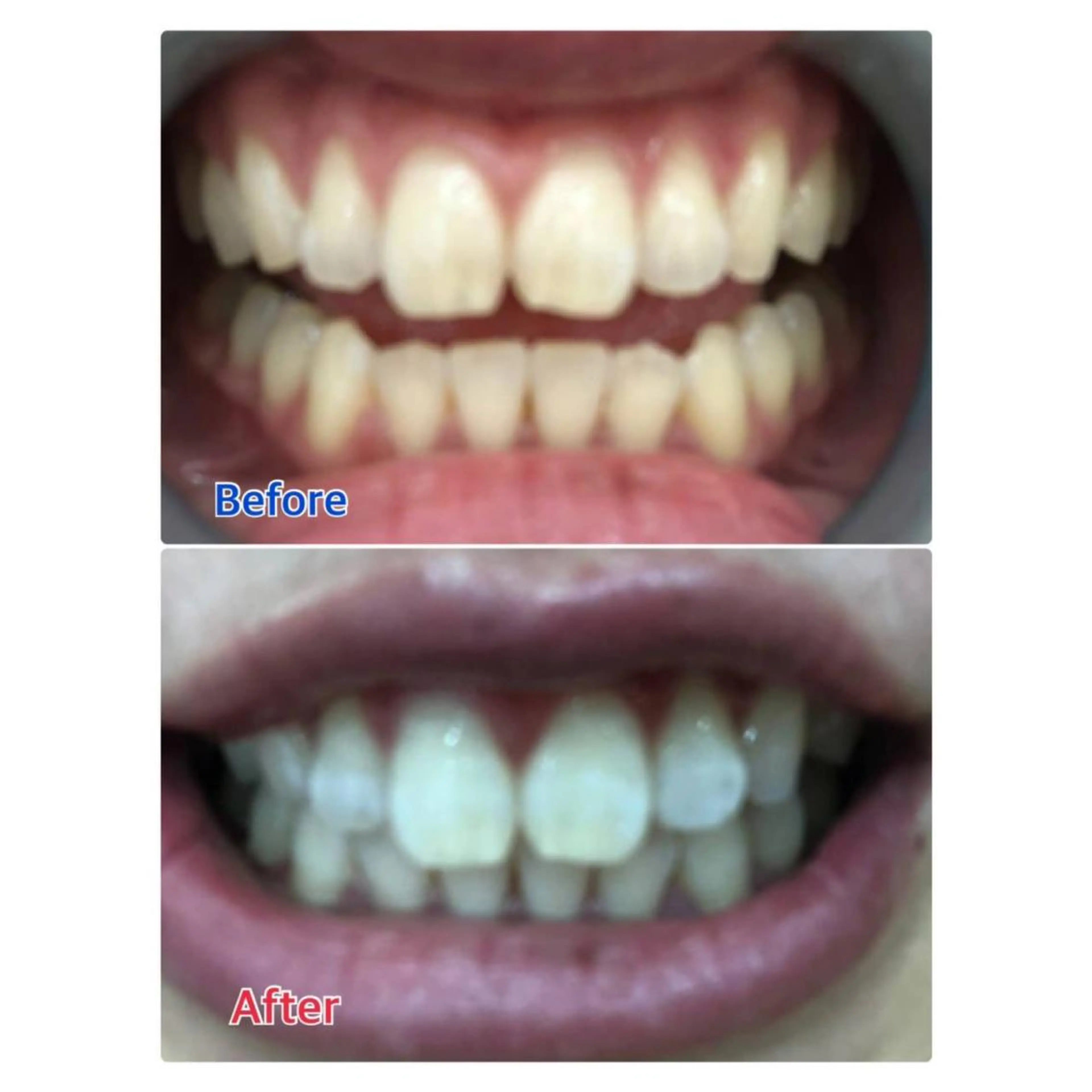 MBEAUTYSALON 千葉店・京成大久保所属・Melty 輝のその他イメージ