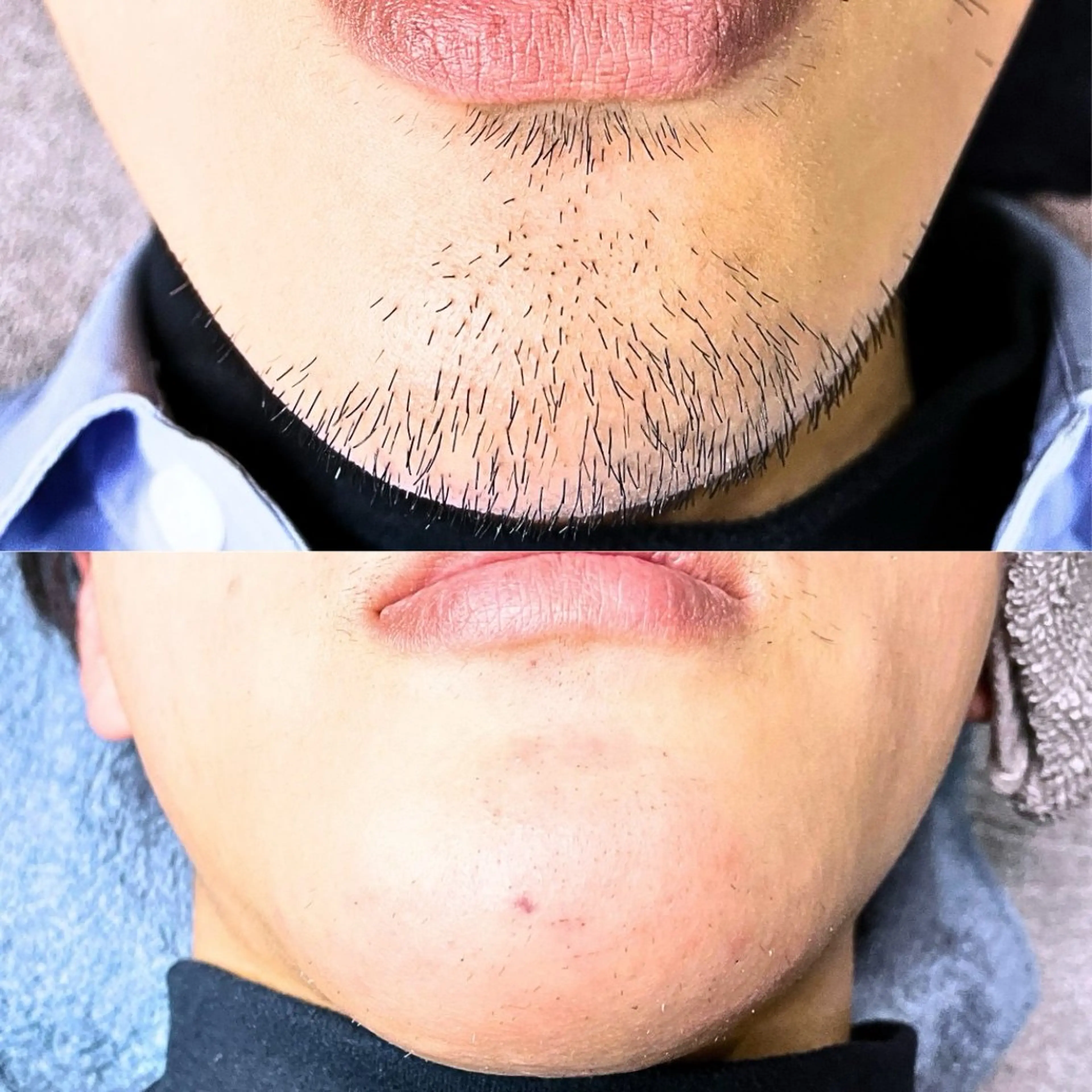 メンズ 【一本ずつ脱毛】 ReMove 柏のエステ・リラクイメージ