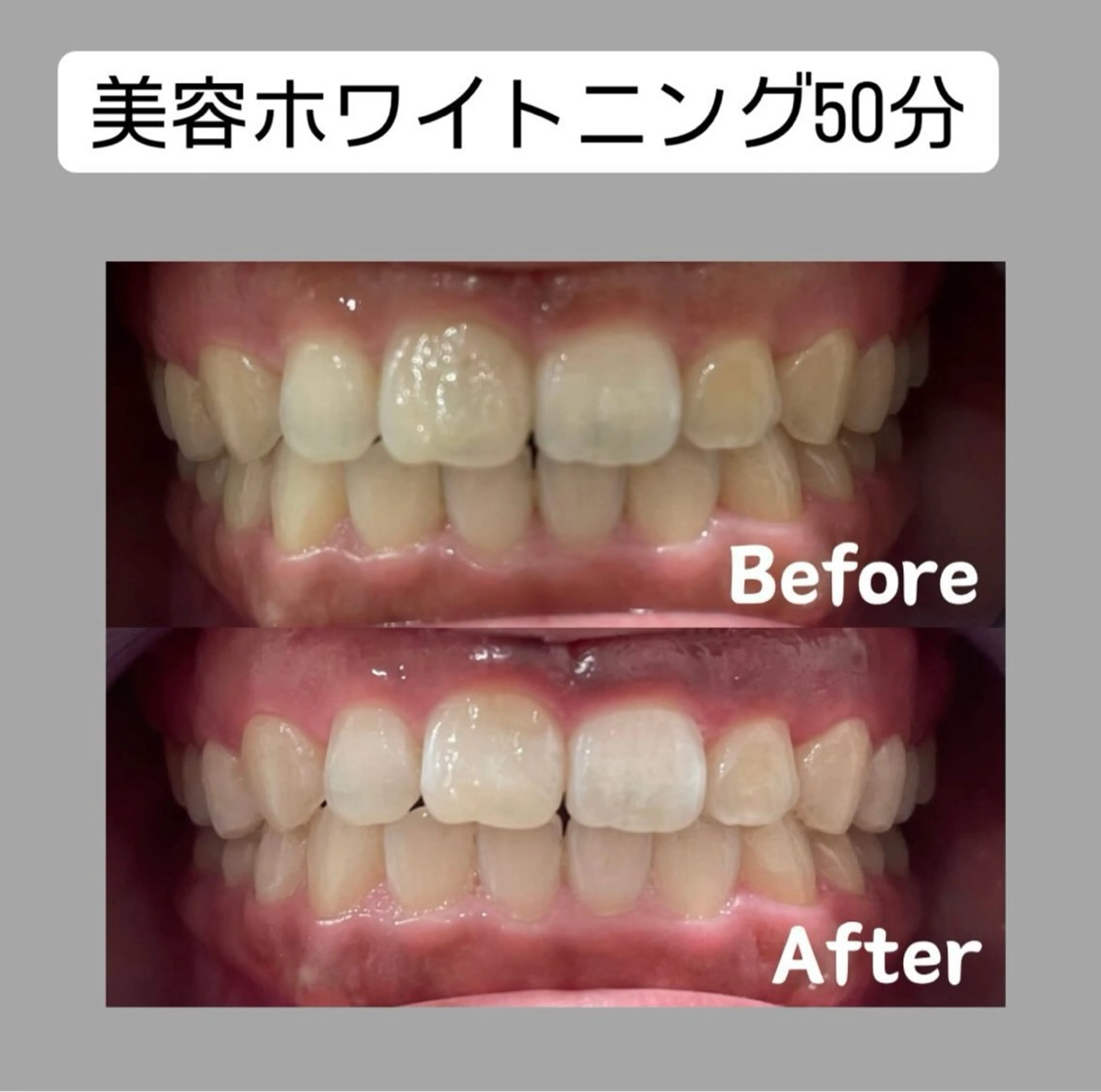 Kaula ホワイトニング🦷✨のエステ・リラクイメージ