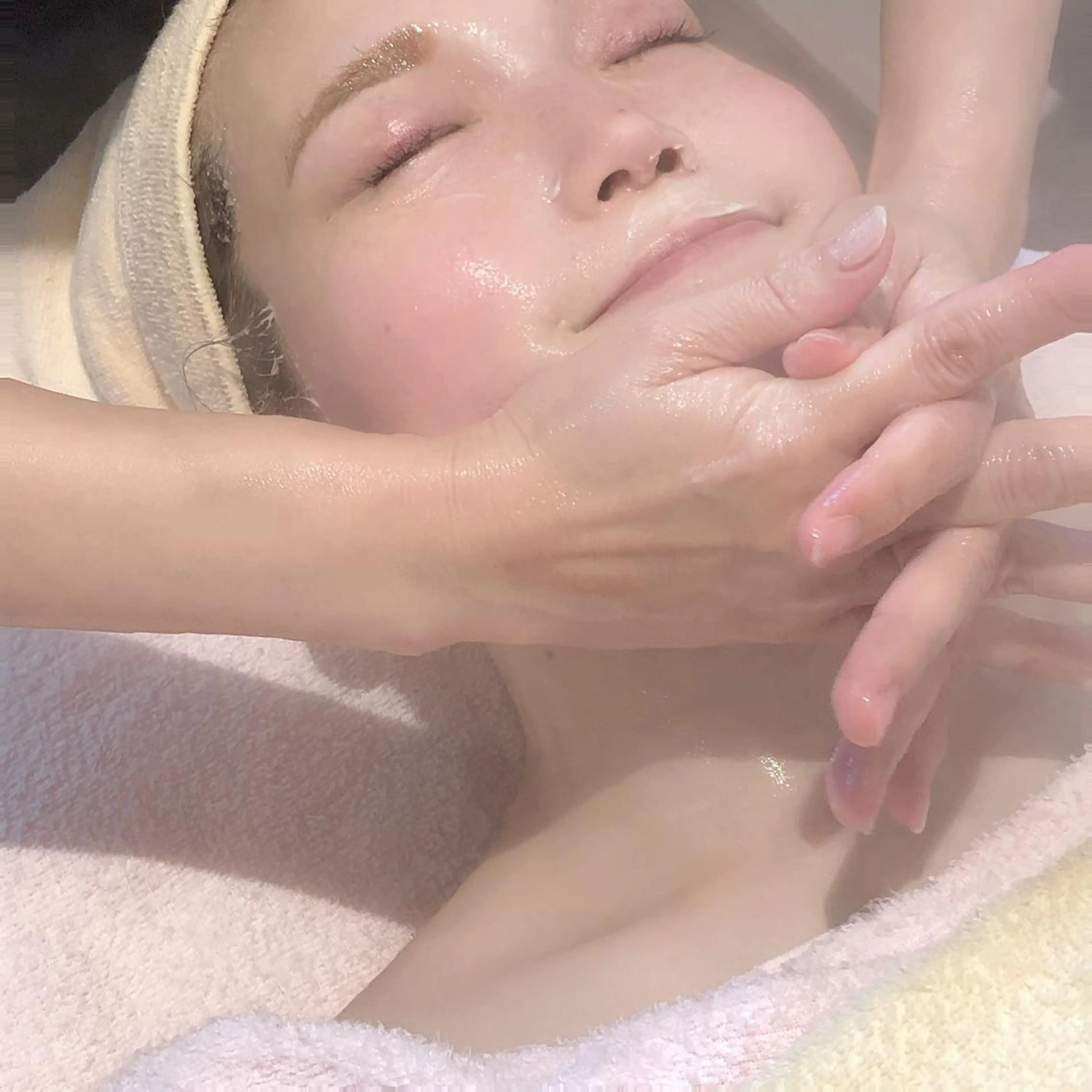 ★集中美白・美人プラン★シミ・肝斑・くすみ・色黒の写真