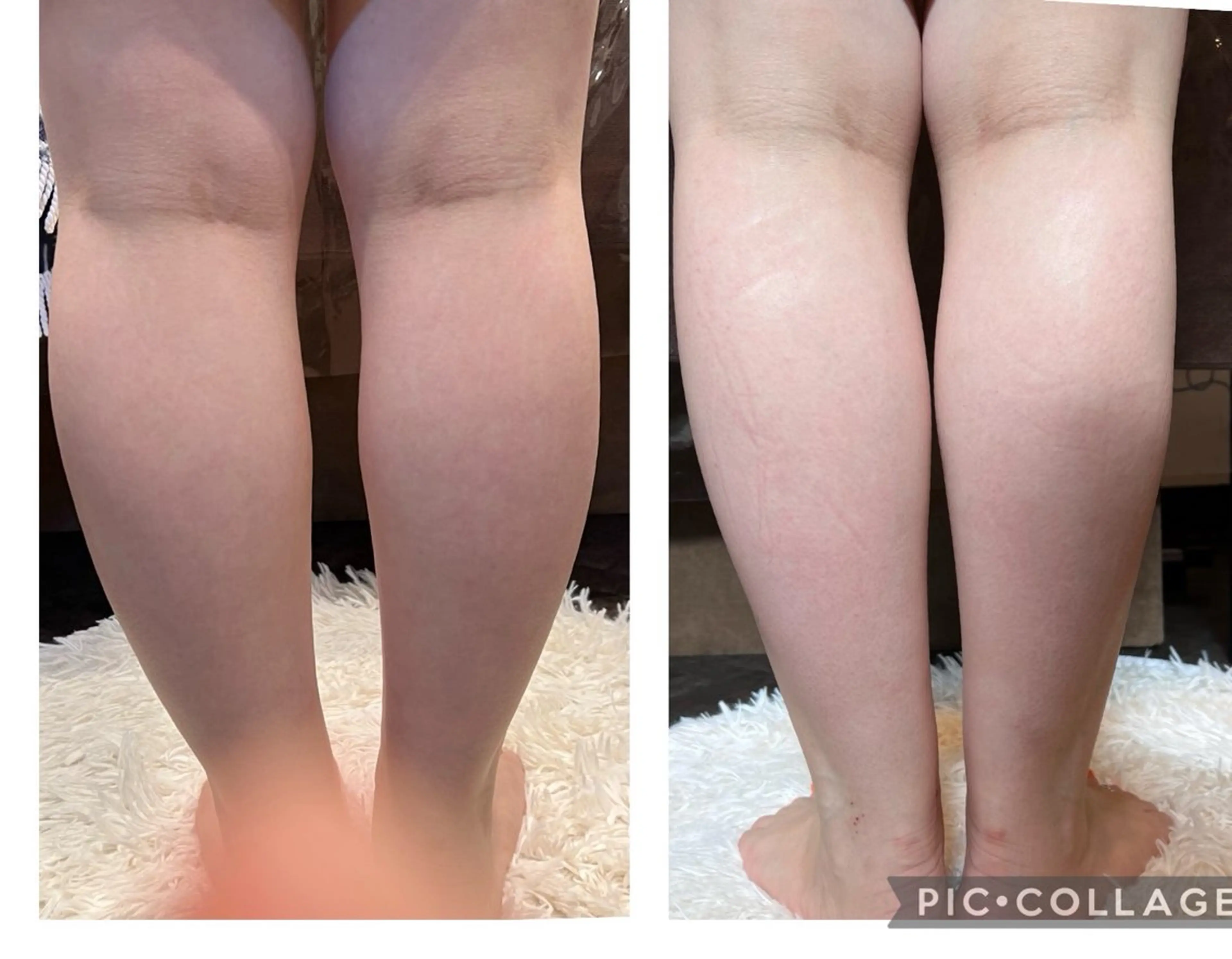 エステ リラク 🅖🅤🅩🅔🅛 salonのエステ・リラクイメージ